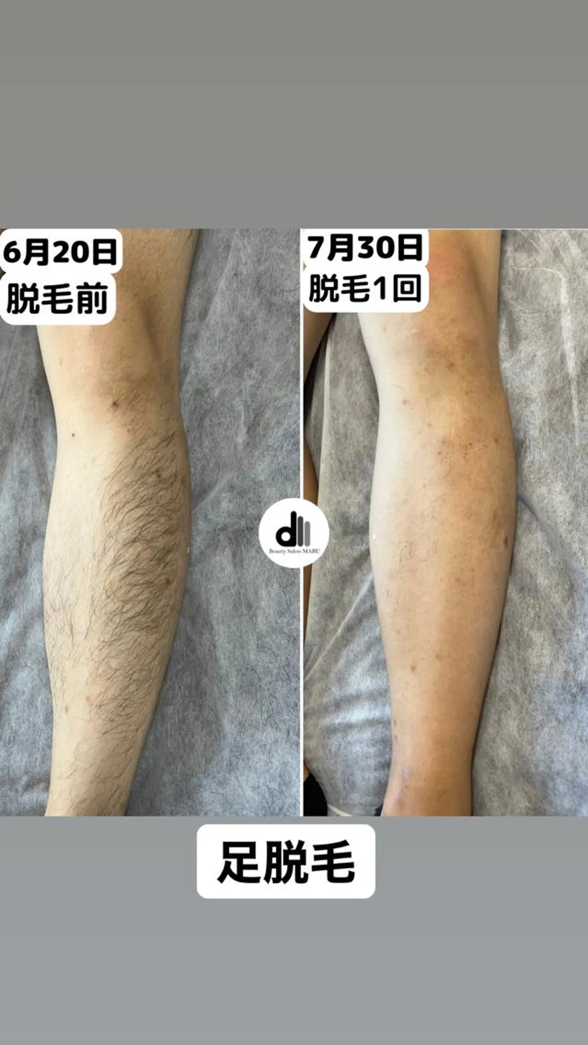 メンズ Beauty Salon MARU所属・新潟市メンズ【脱毛】 MARUのエステ・リラクイメージ