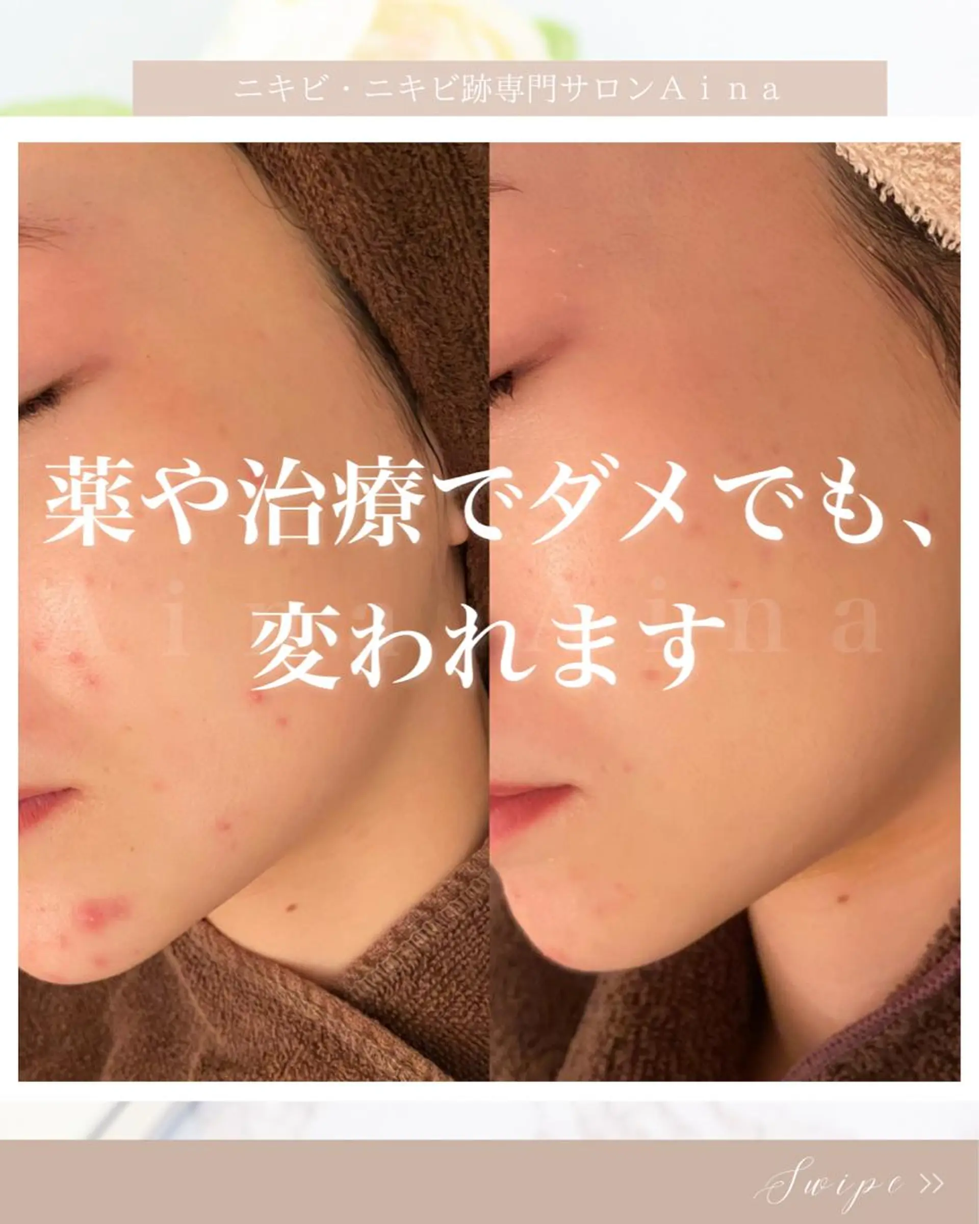 セミロング カラー パーマ ヘアアレンジ メンズ キッズ ネイル マツエク・マツパ アイブロウ 赤色 エステ リラク ニキビ跡専門サロン Ａｉｎａのエステ・リラクイメージ