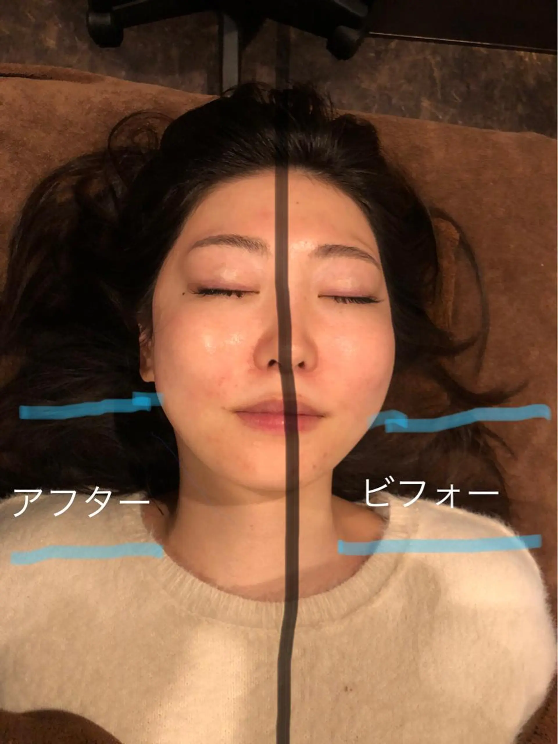 その他 美容鍼灸サロン LOMIHARIのエステ・リラクイメージ