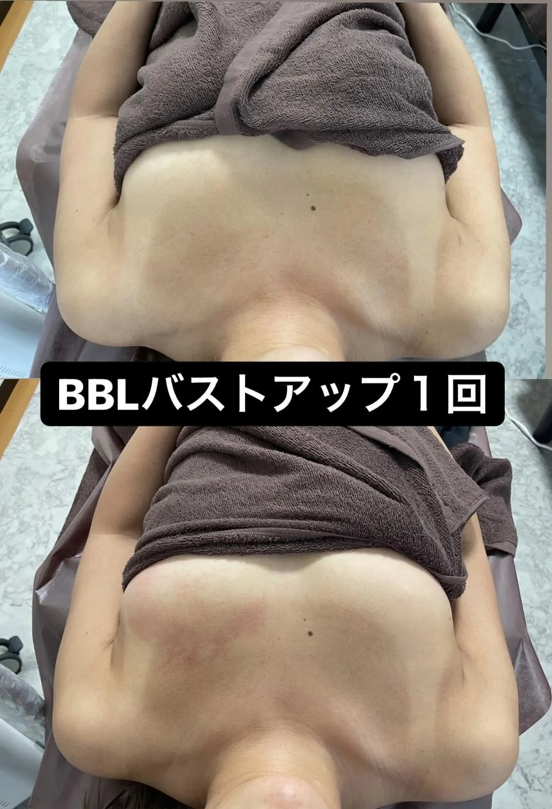 Epina 千葉店 【エピナ】のエステ・リラクイメージ