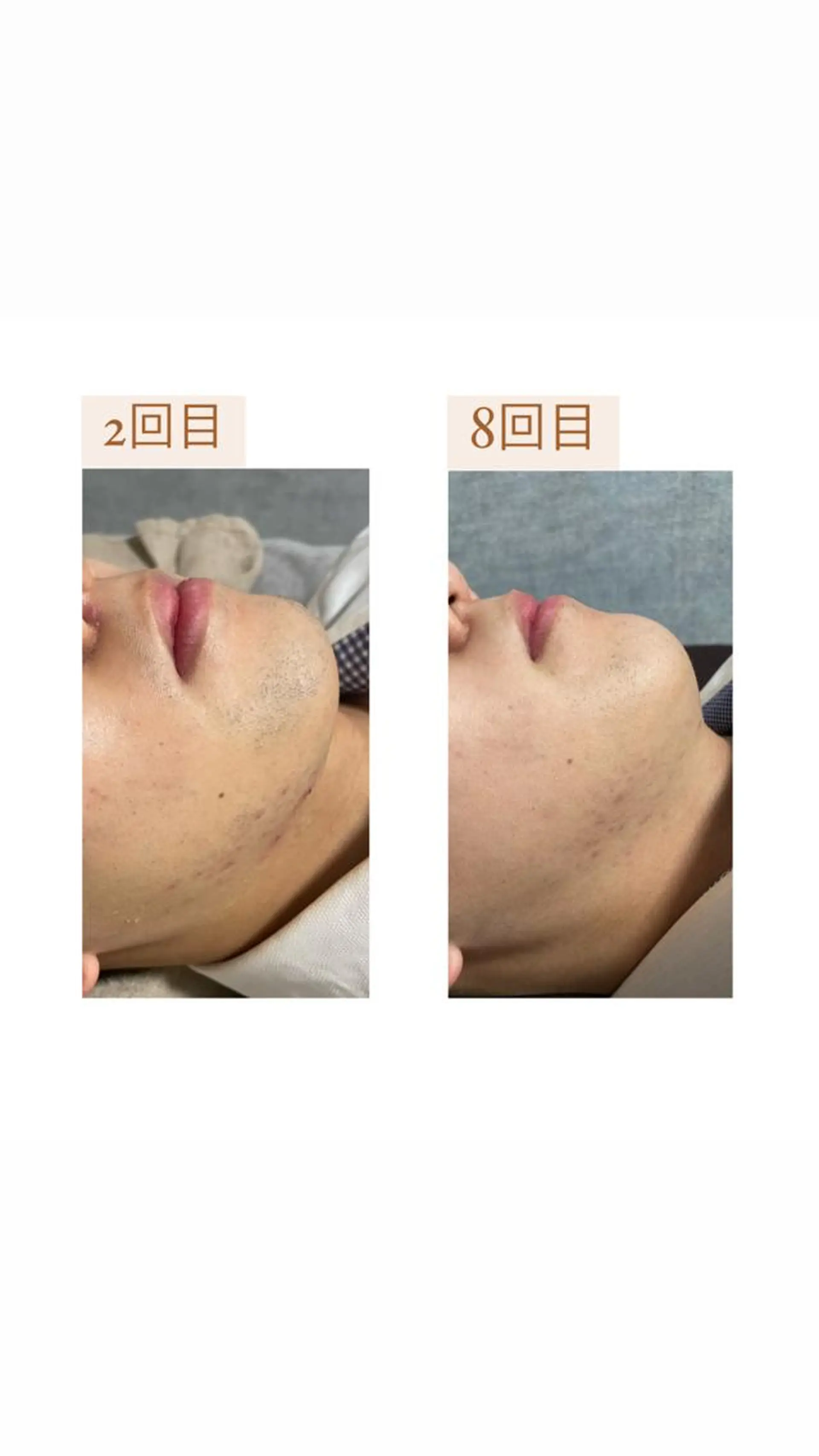 crescent所属・【韓国肌管理・脱毛】 クレセントのエステ・リラクイメージ