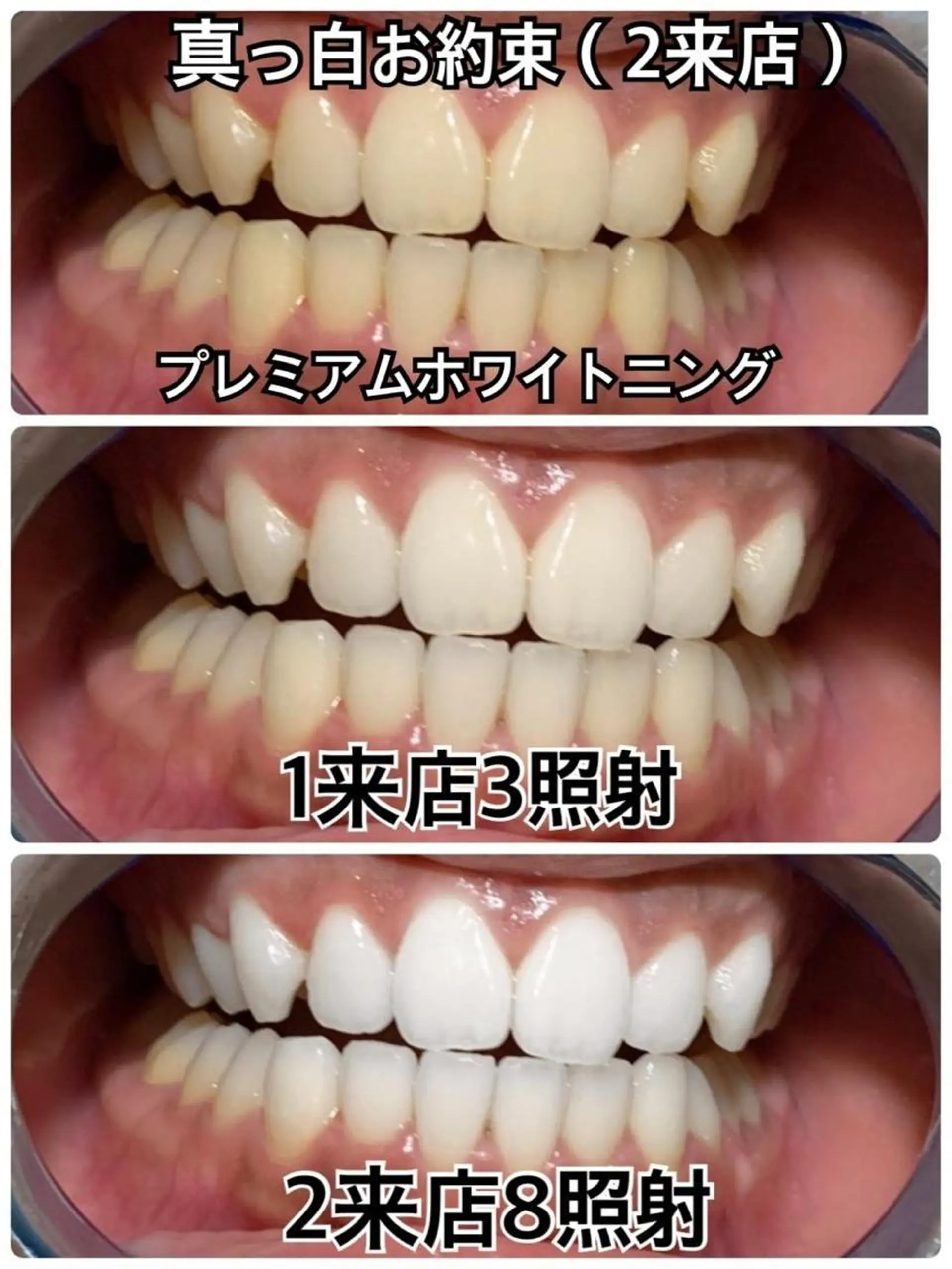 ホワイトニングビューティー西宮店所属・ホワイトニングビュー ティー西宮店のその他イメージ