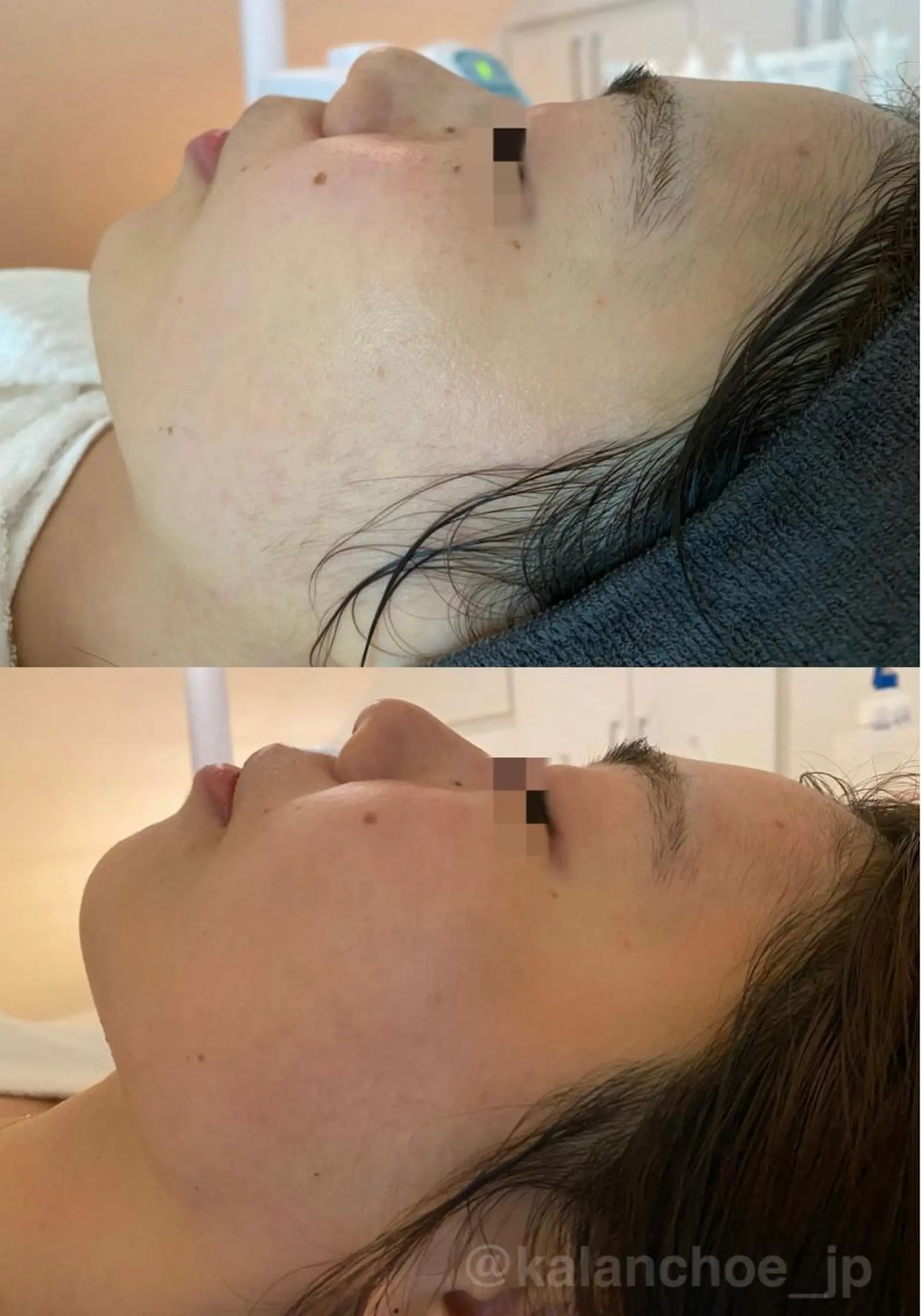 エステ 肌質改善 KALANCHOEのエステ・リラクイメージ