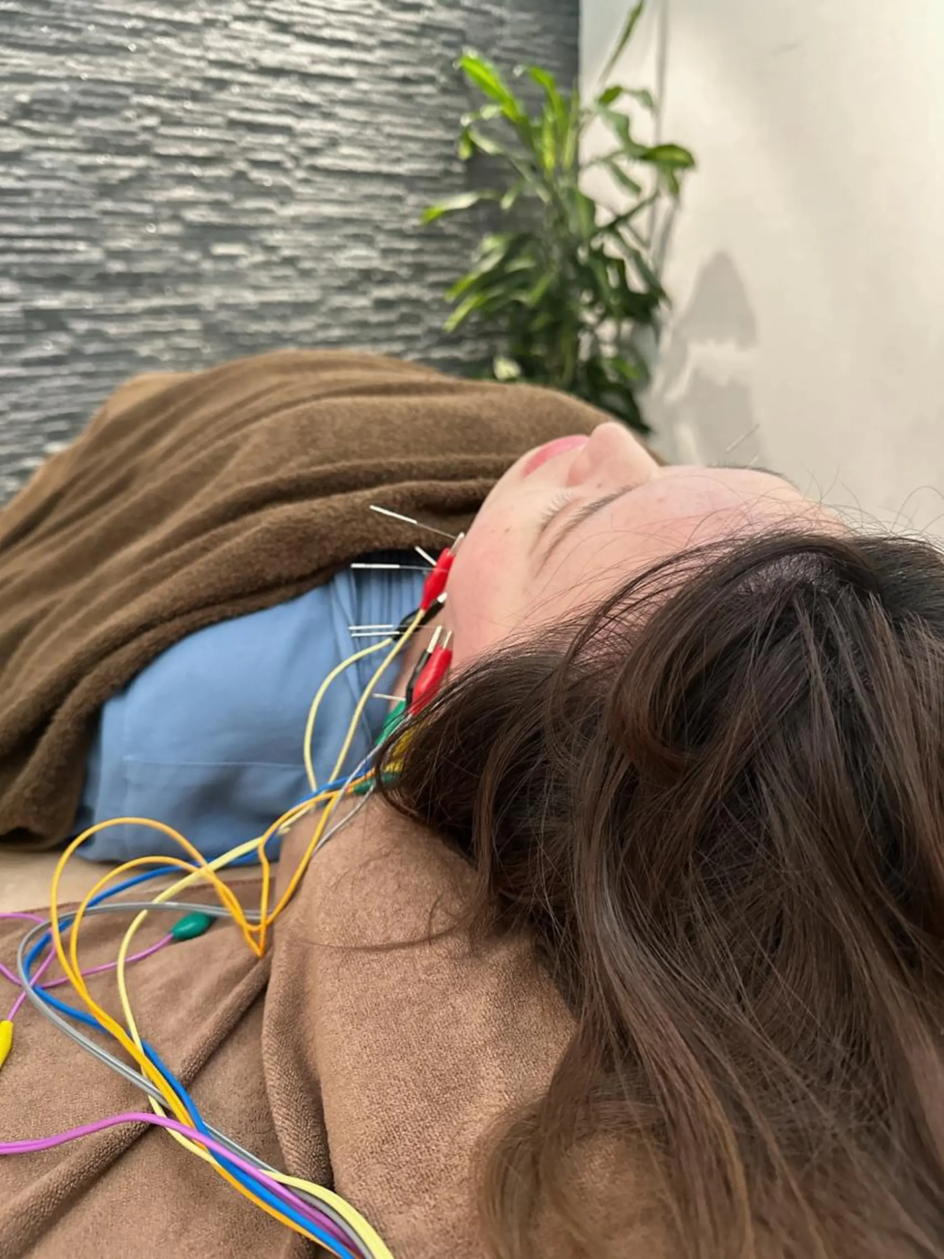 その他 美容鍼灸整体サロンBeauJu所属・小顔矯/美容鍼/鍼灸 BeauJuのその他イメージ