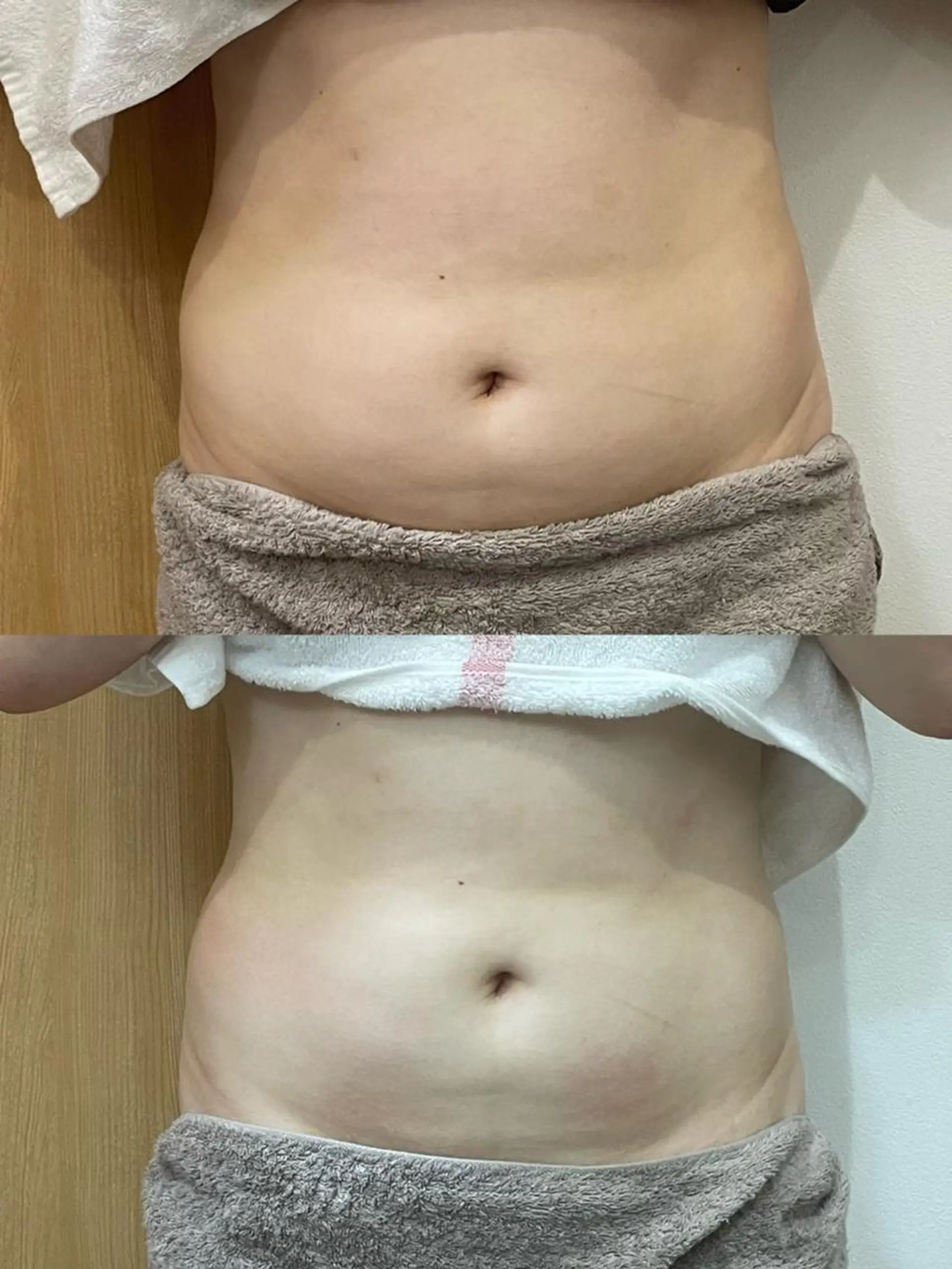 その他 OPREA 千種店のエステ・リラクイメージ