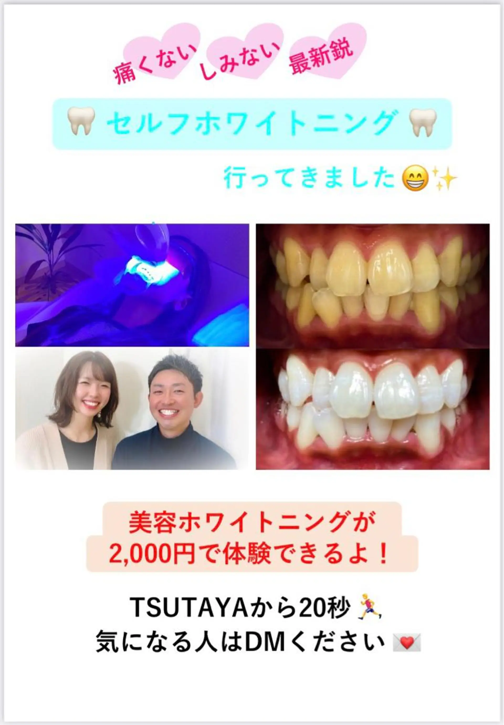 セミロング メンズ キッズ その他 セルフホワイトニングサロン　ラヴィアン所属・ホワイトニングサロン La vie enのその他イメージ