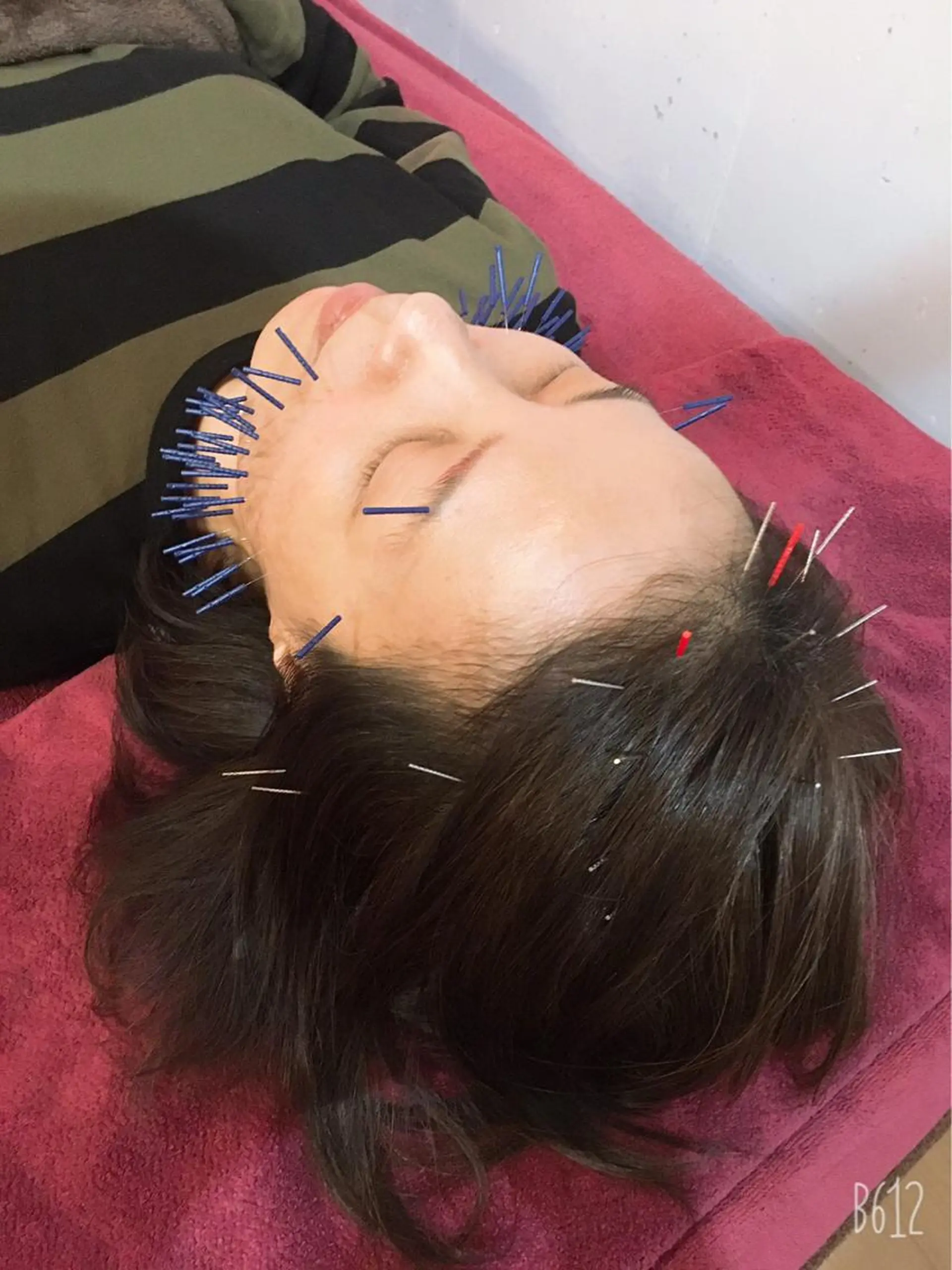 エステ リラク 美容鍼灸女性専用 りんご鍼灸治療院のその他イメージ