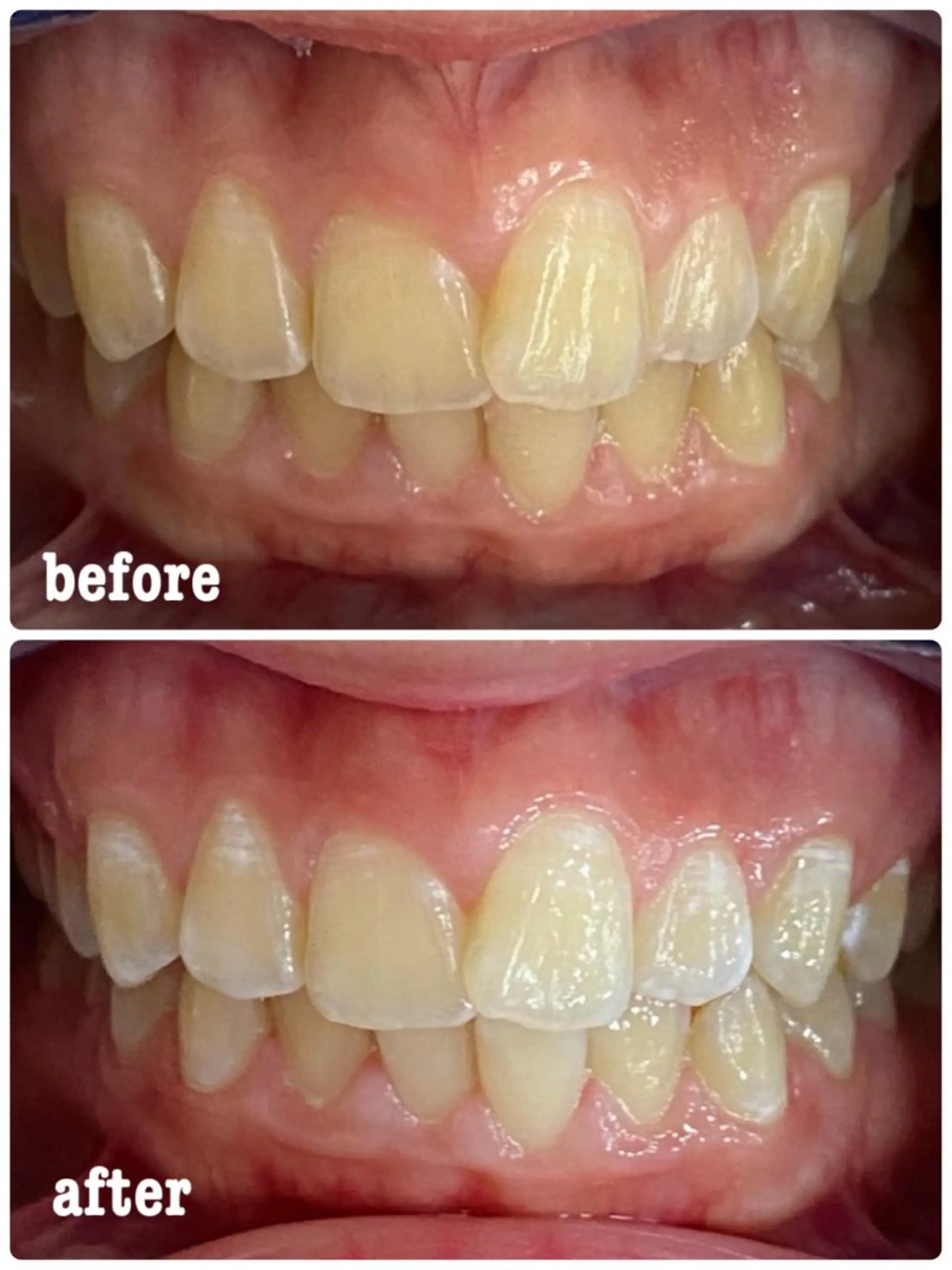 ホワイトニングサロン ラウレアのその他イメージ