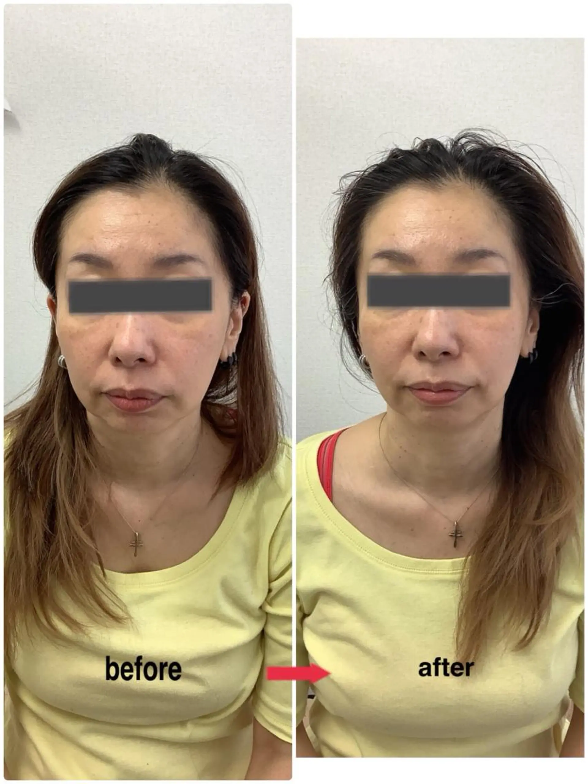 エステ リラク メディカルサロンドオフ所属・ハリサロンドオフ 美容鍼灸×小顔整体のエステ・リラクイメージ