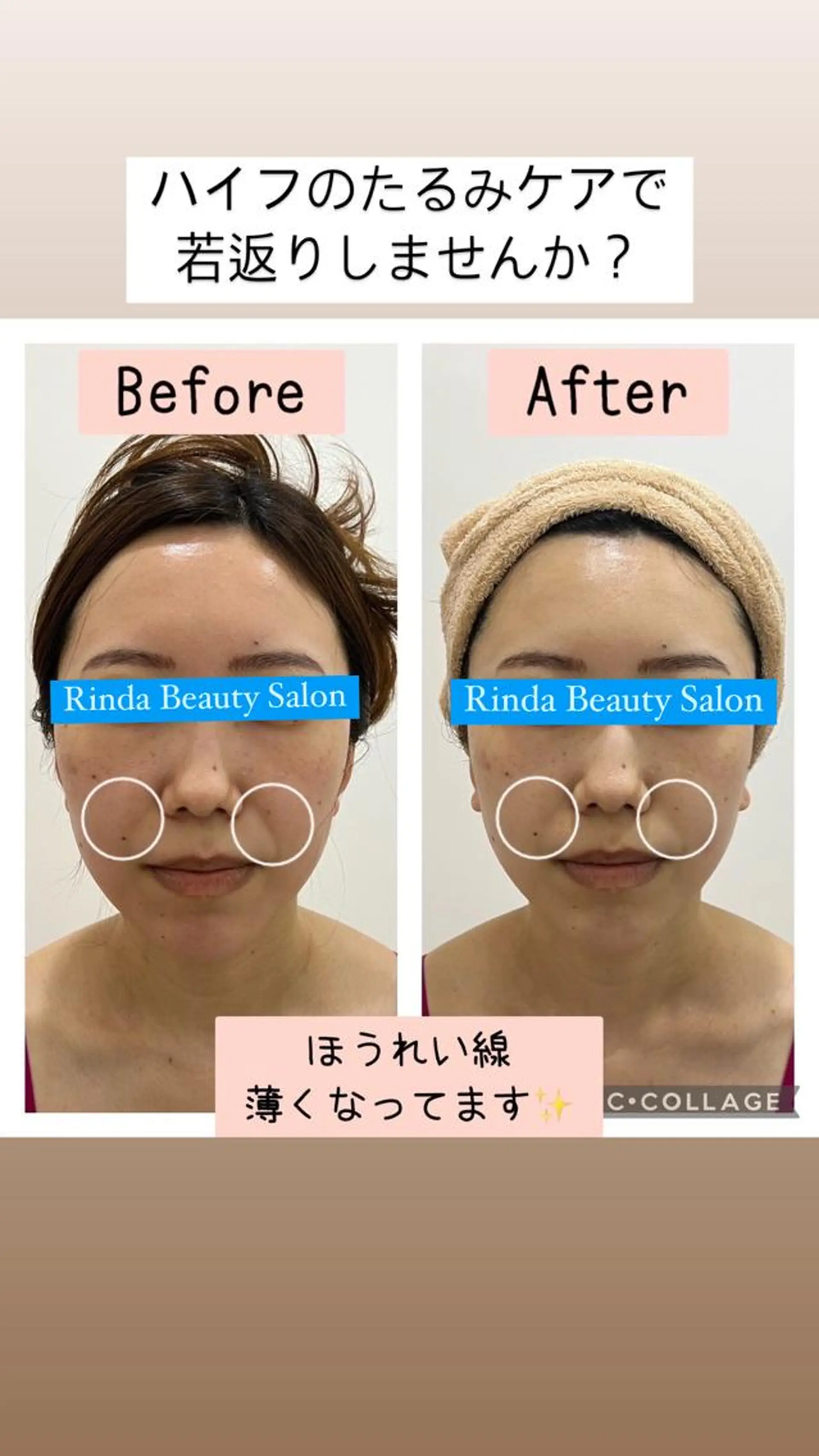 Rinda 尼崎駅前サロンのエステ・リラクイメージ