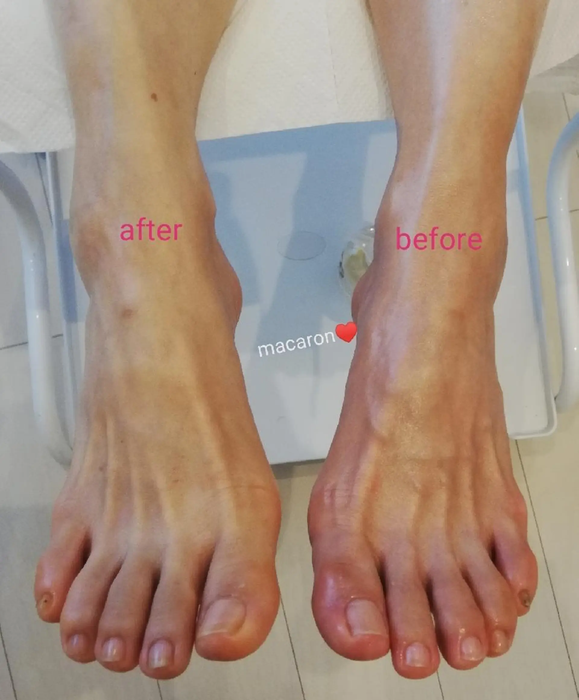 ネイル フットネイル リラク macaron♥所属・nail salon macaron のネイルデザイン