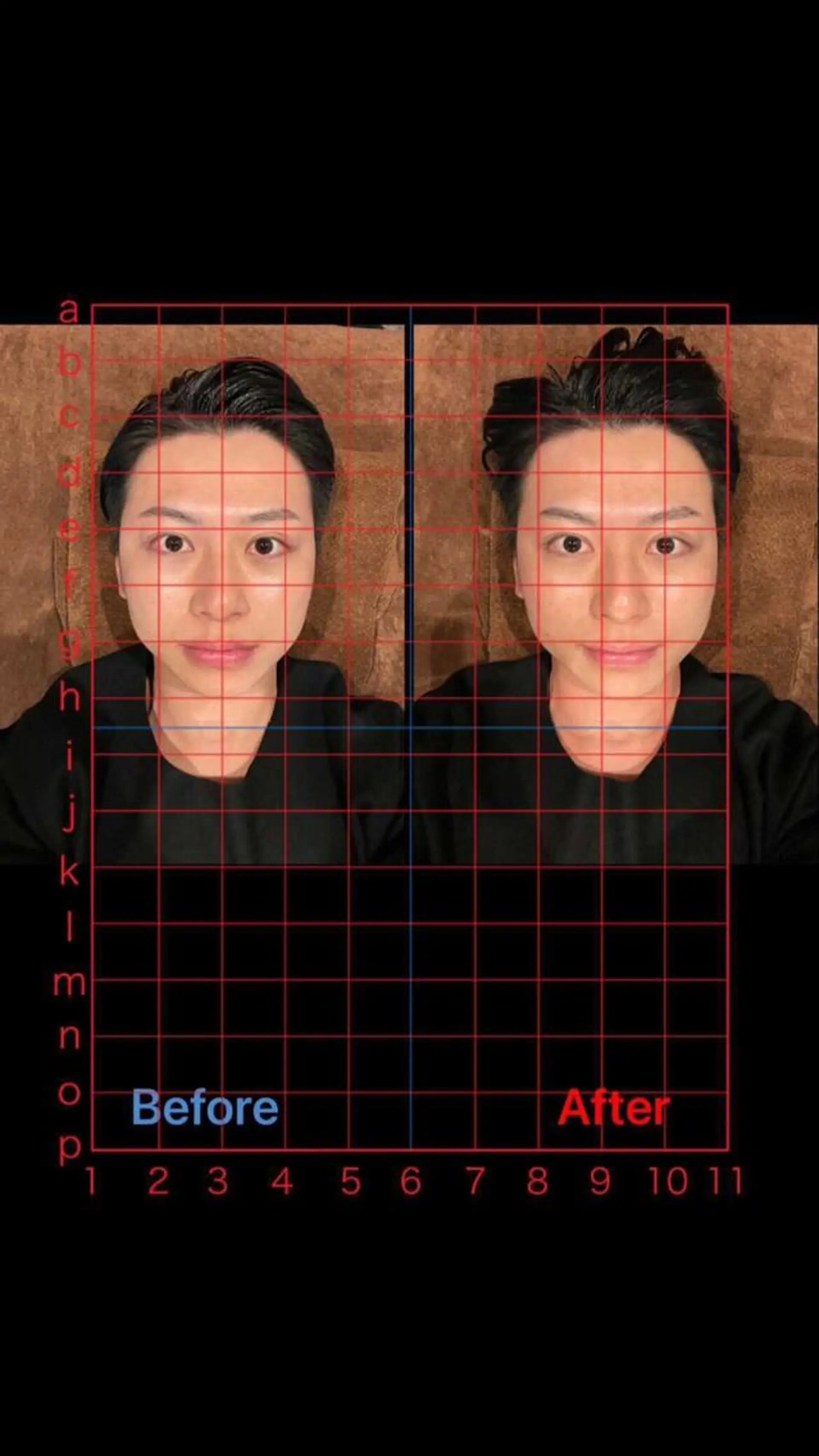 美容鍼灸サロン LOMIHARIのエステ・リラクイメージ