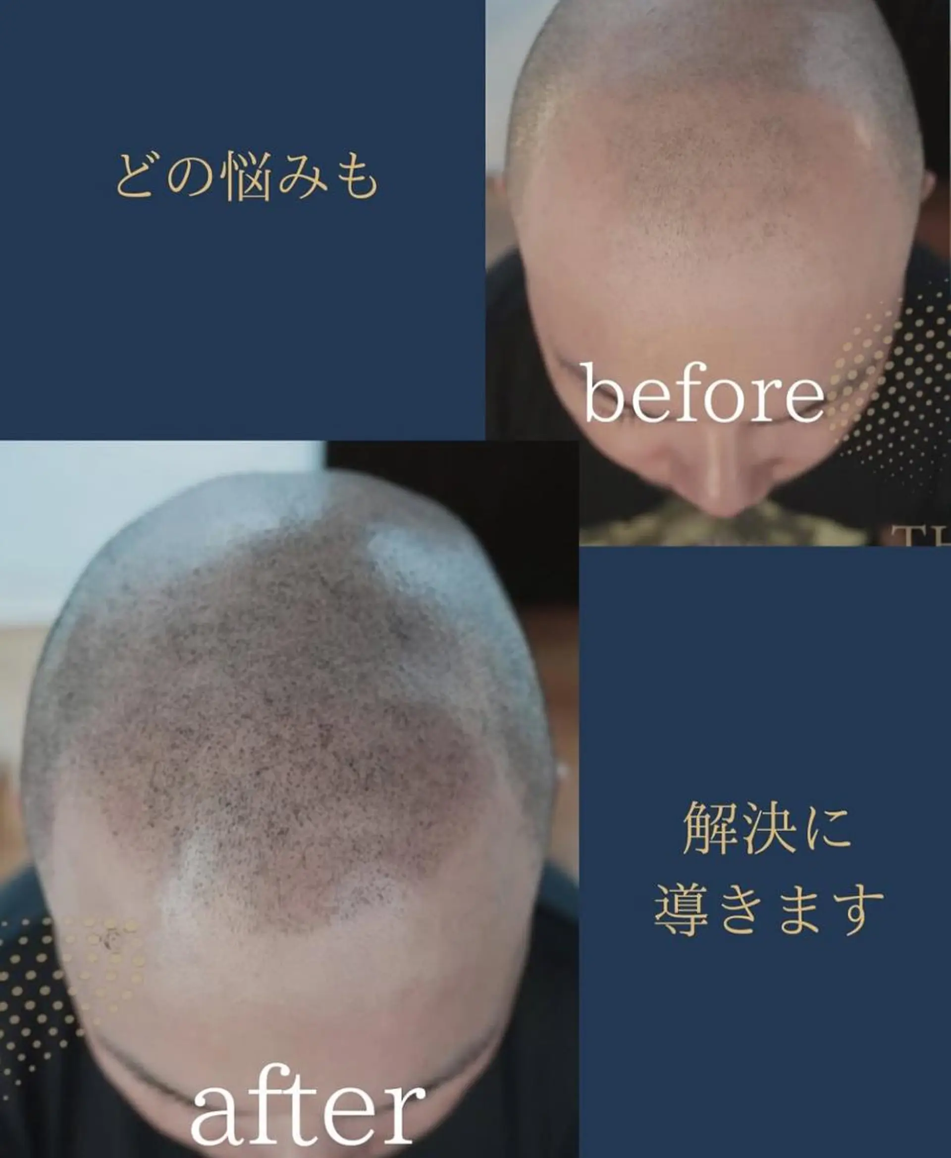 メンズ W eye+東口店/ SCALP INKのマツエク・マツパデザイン
