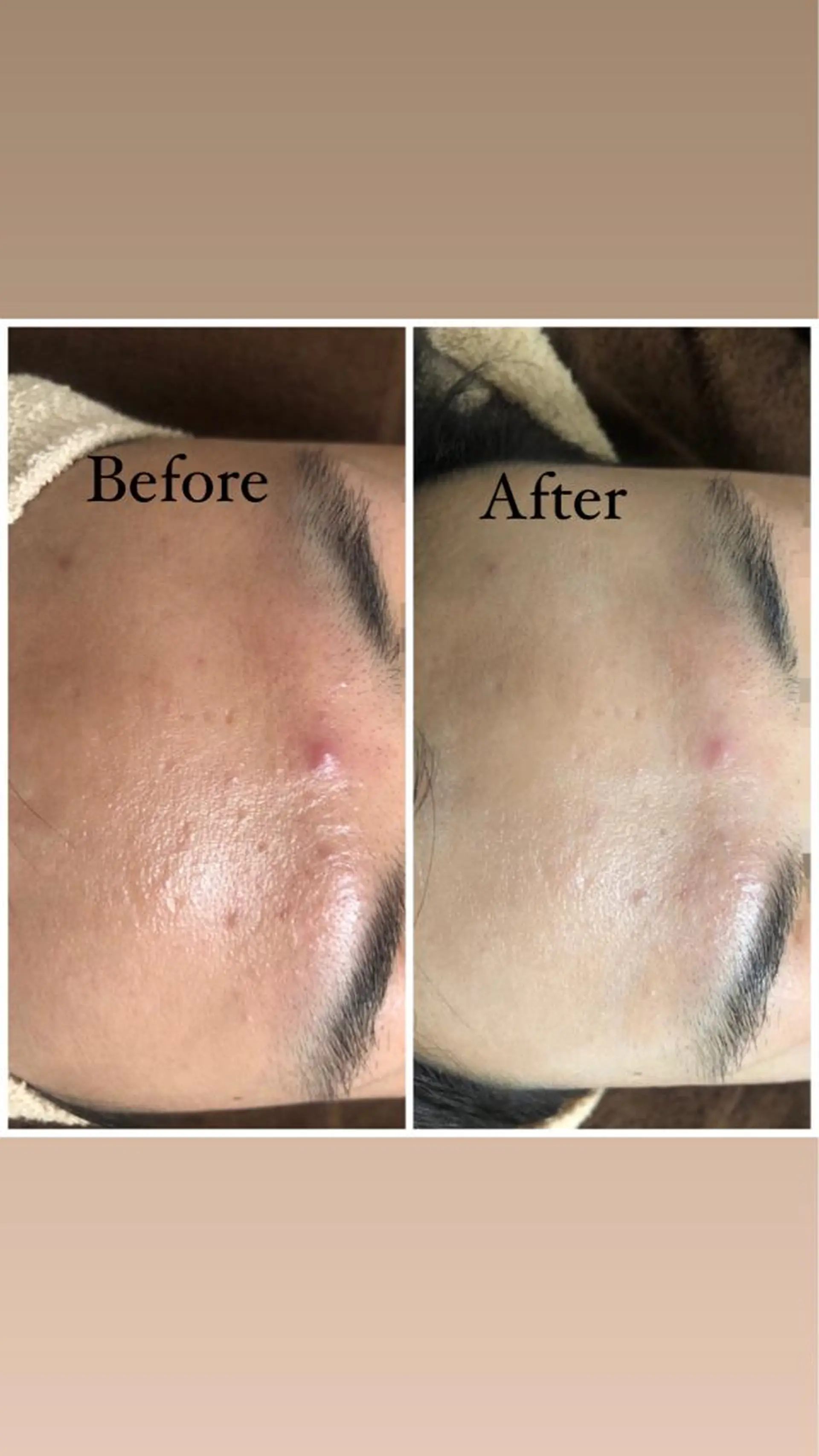 セミロング カラー パーマ ヘアアレンジ メンズ キッズ ネイル マツエク・マツパ Amaryllis 🌹のエステ・リラクイメージ