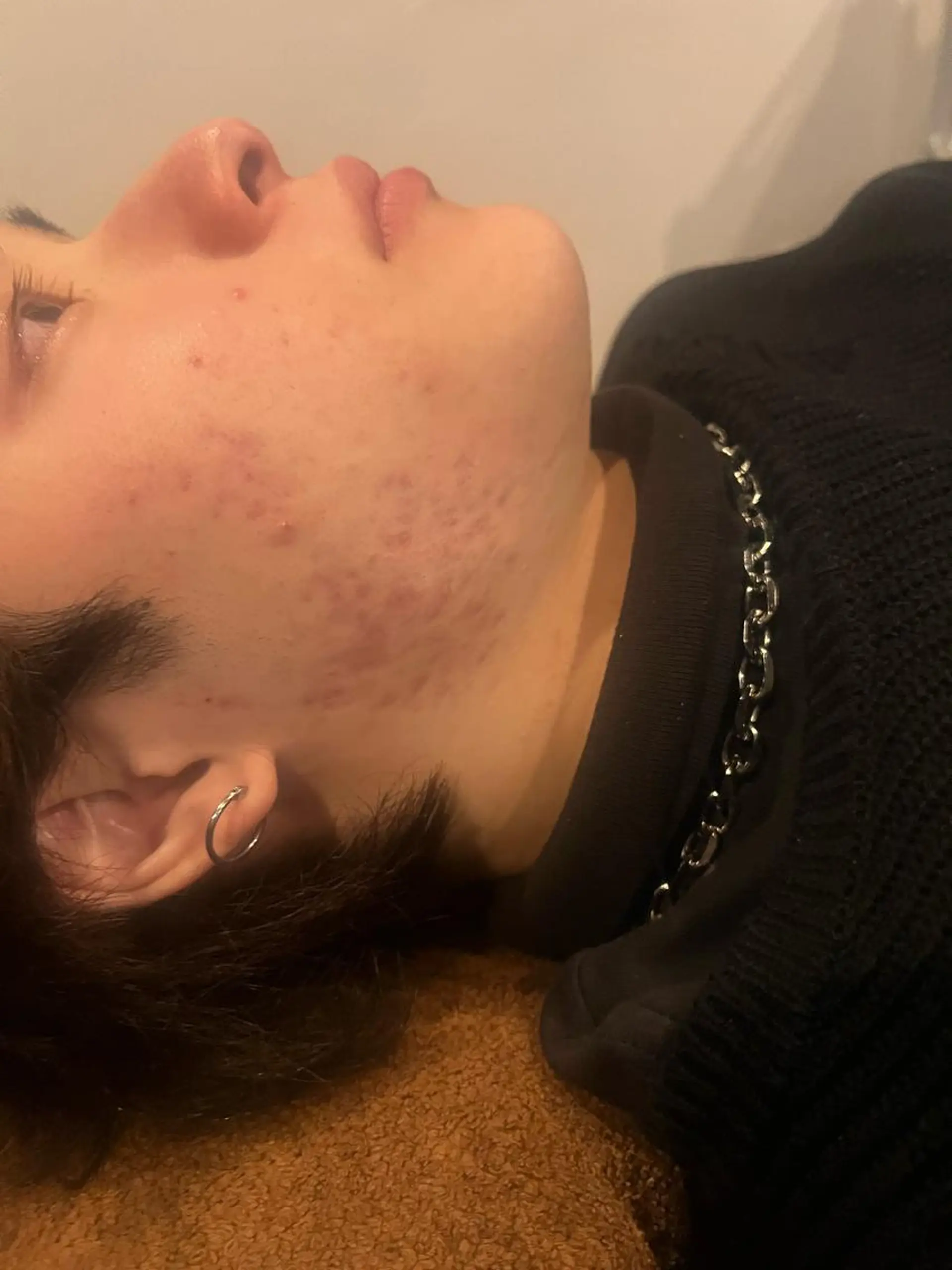 メンズ エステ リラク 美容鍼灸サロン LOMIHARIのエステ・リラクイメージ