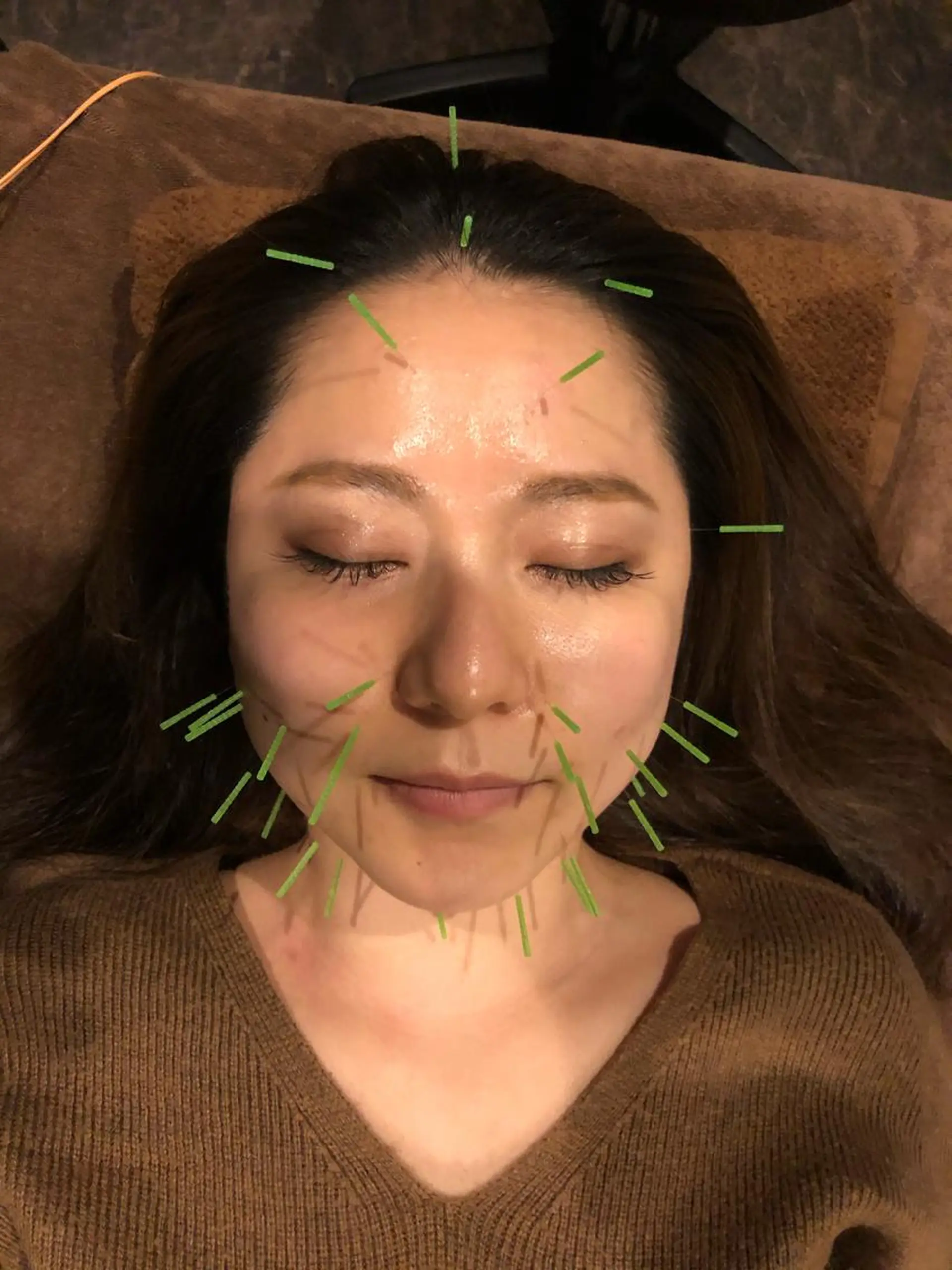 メンズ エステ リラク 美容鍼灸サロン LOMIHARIのエステ・リラクイメージ