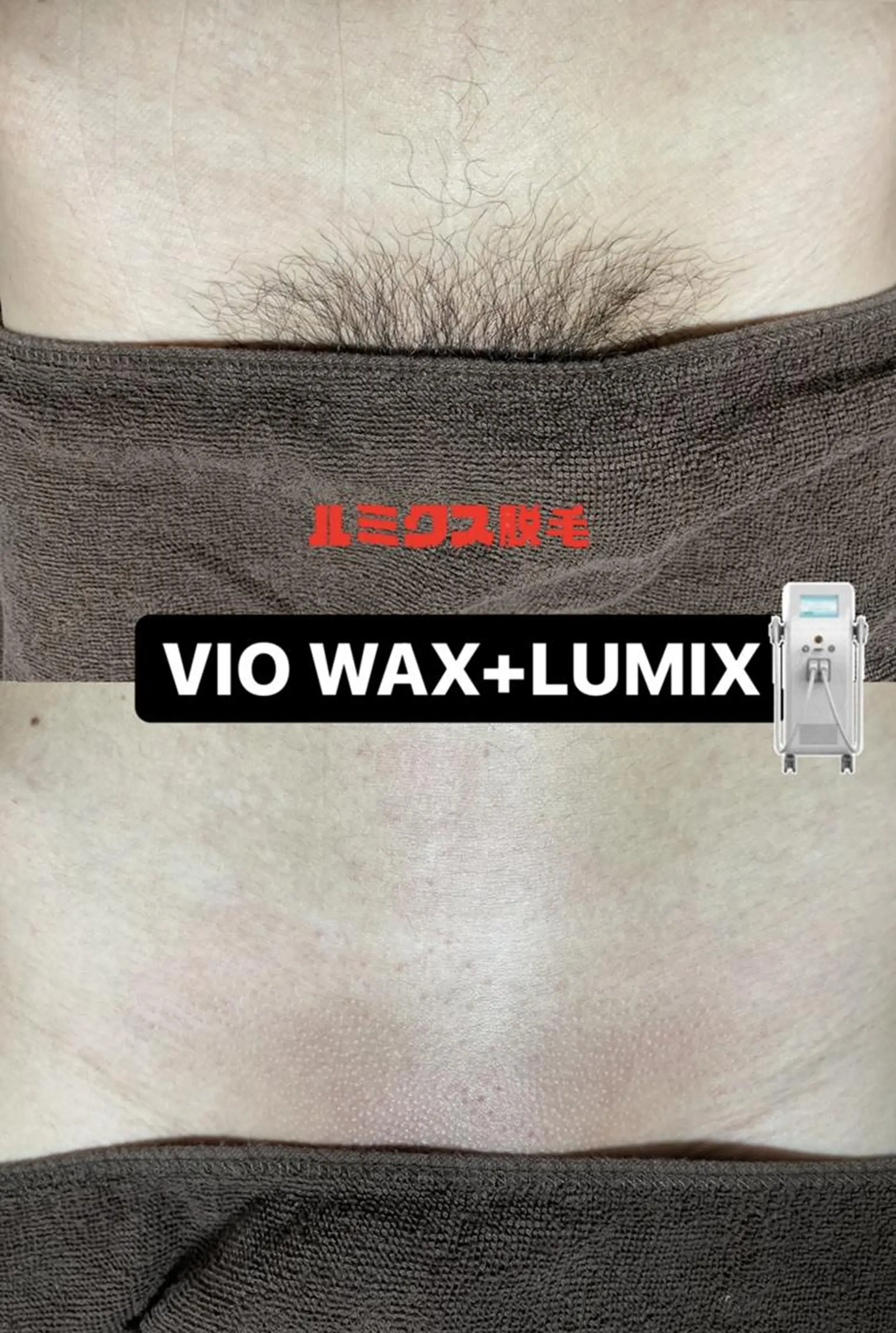 キッズ メンズ 脱毛 Epina 千葉店 【エピナ】のエステ・リラクイメージ