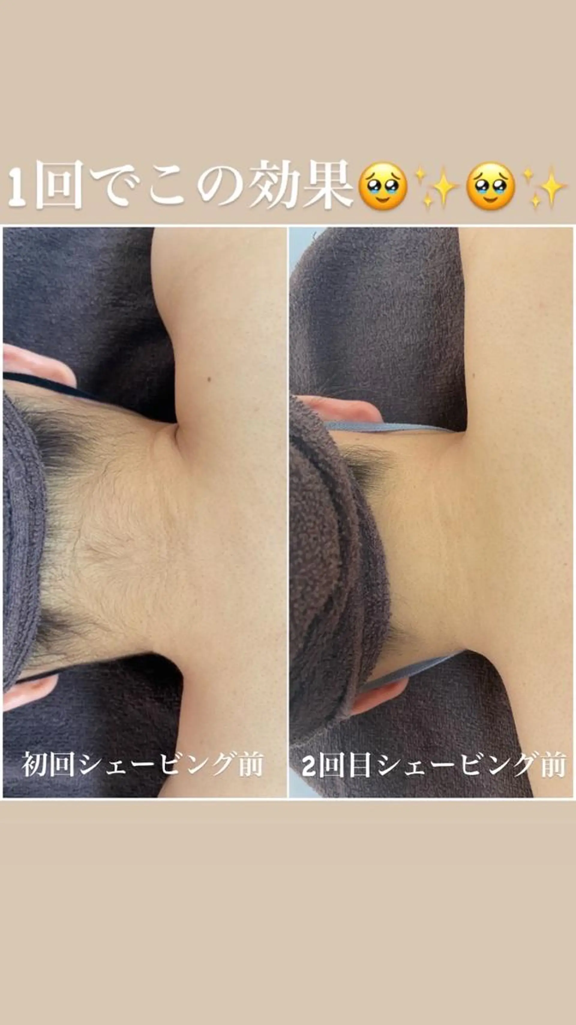 脱毛 都度払い制脱毛サロンBe Charm所属・Be Charm 山﨑のエステ・リラクイメージ