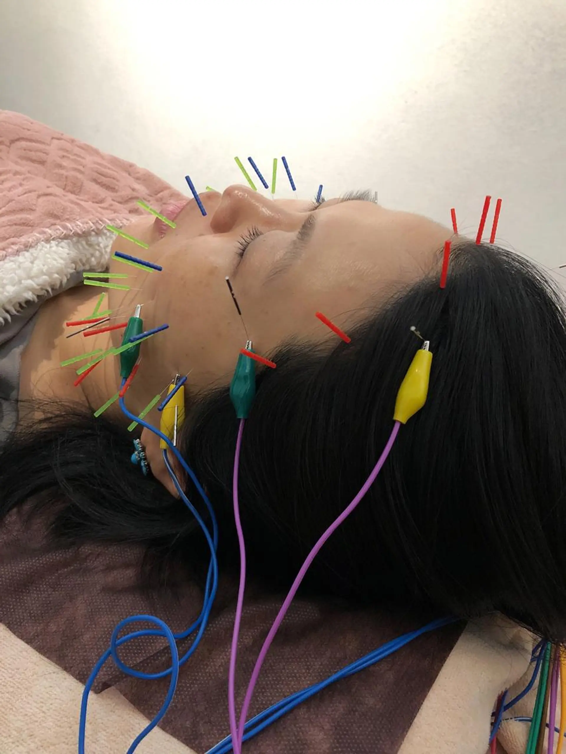 その他 美容鍼灸整体サロンBeauJu所属・小顔矯/美容鍼/鍼灸 BeauJuのその他イメージ