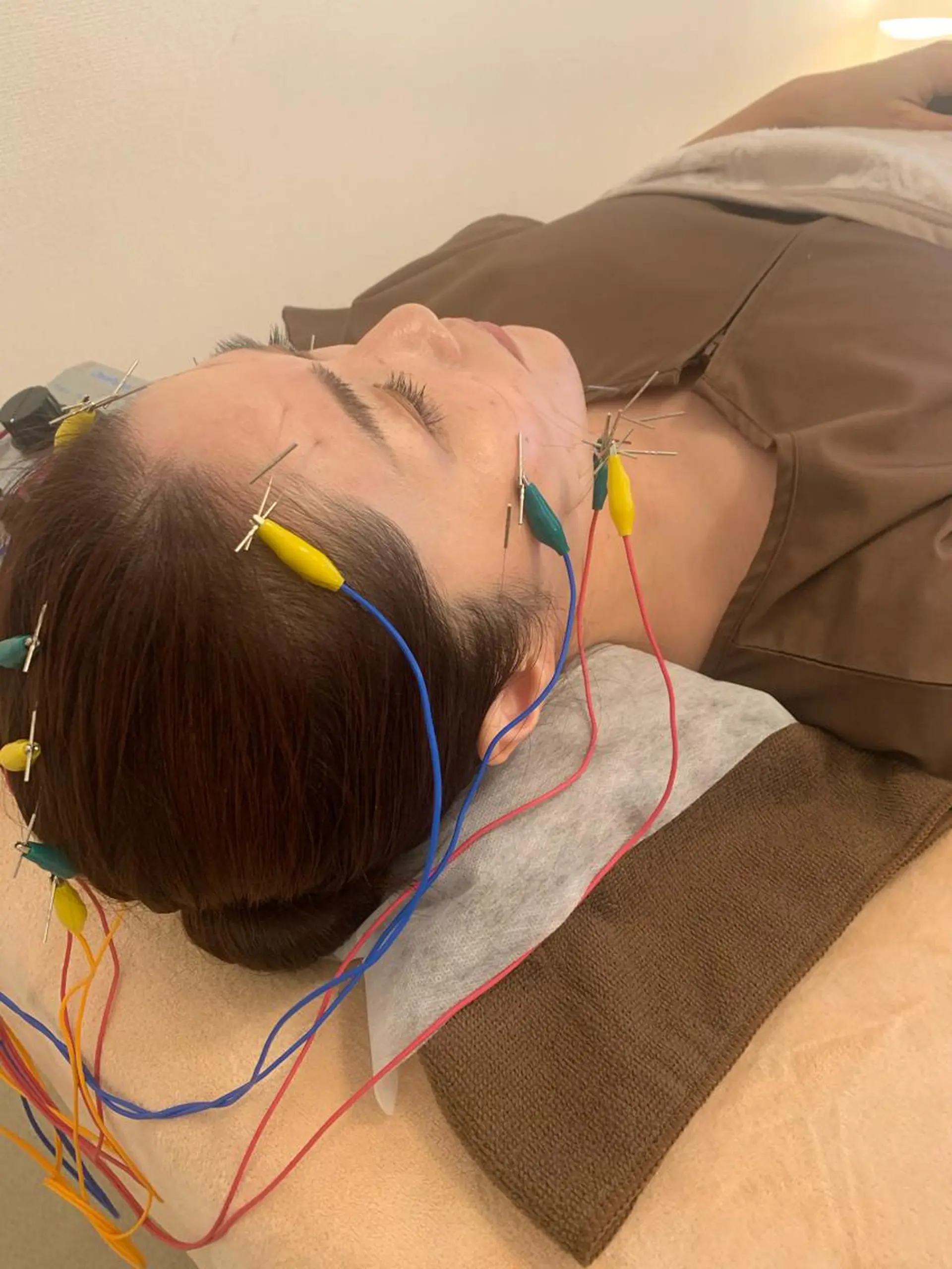 新宿hari-me所属・美容鍼hari-me 新宿のエステ・リラクイメージ