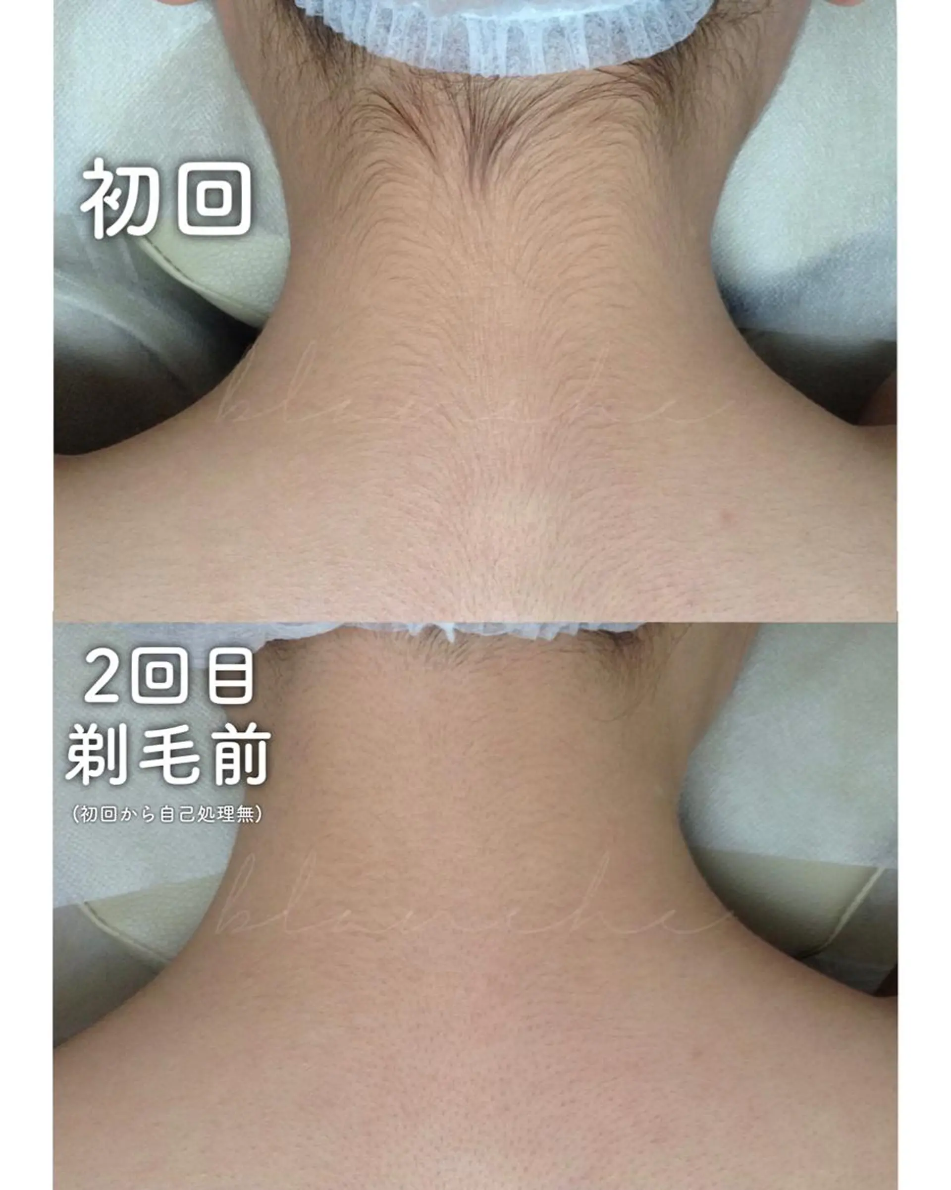 セミロング カラー パーマ ヘアアレンジ ネイル マツエク・マツパ 都度払い肌質改善 &脱毛Blancheのエステ・リラクイメージ