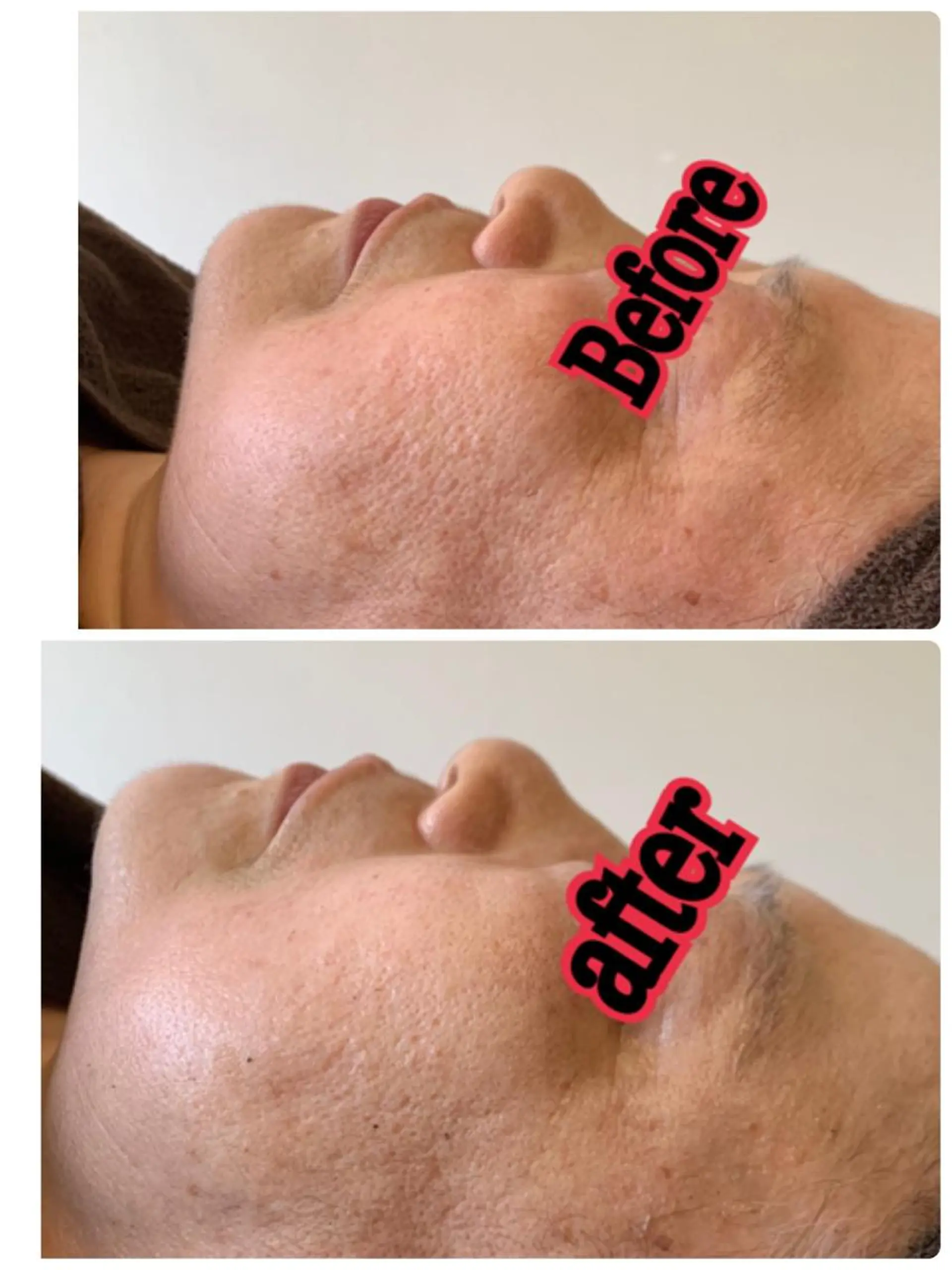 espoir エスポワールのネイルデザイン