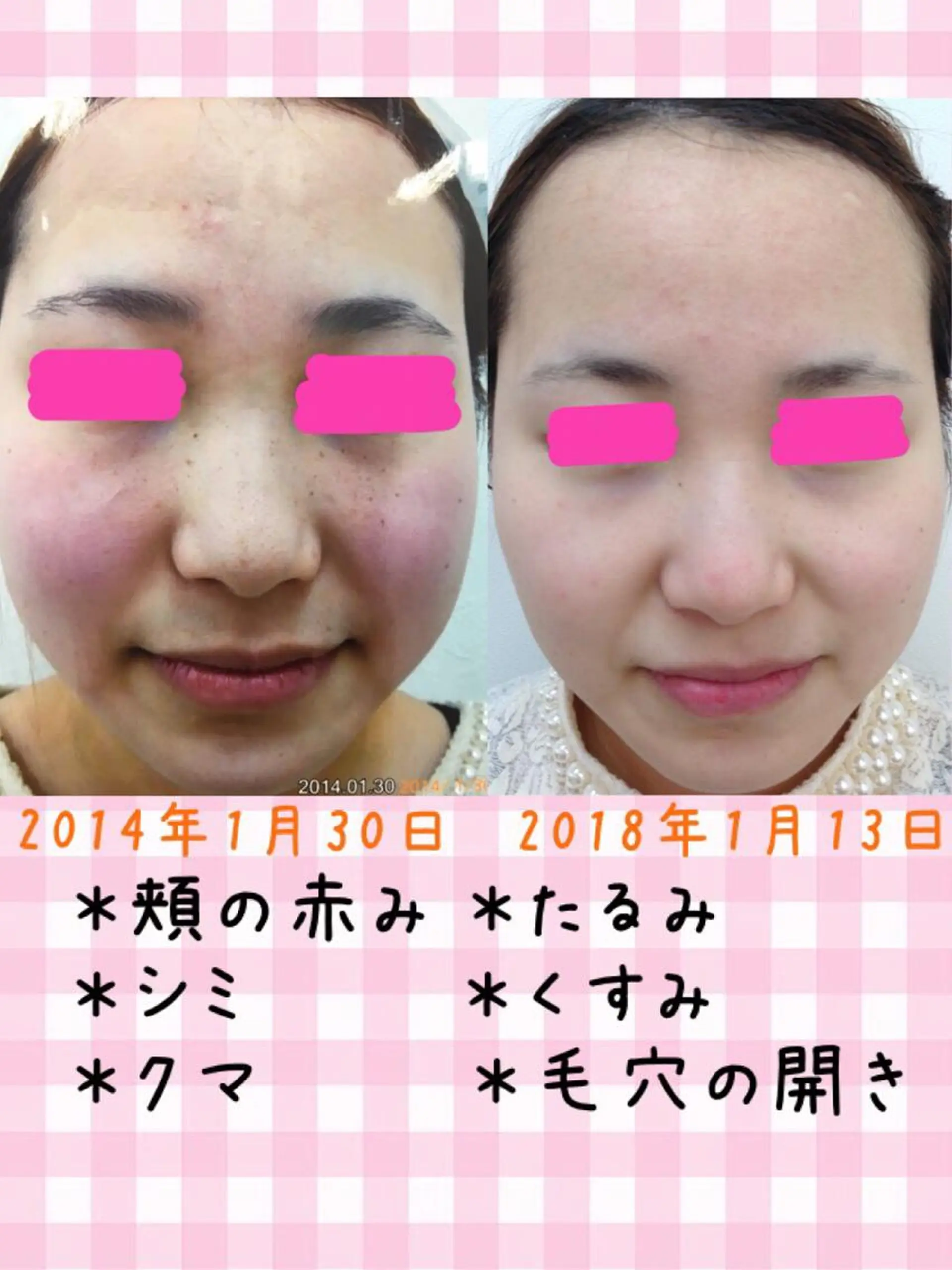 真下 美穂のマツエク・マツパデザイン
