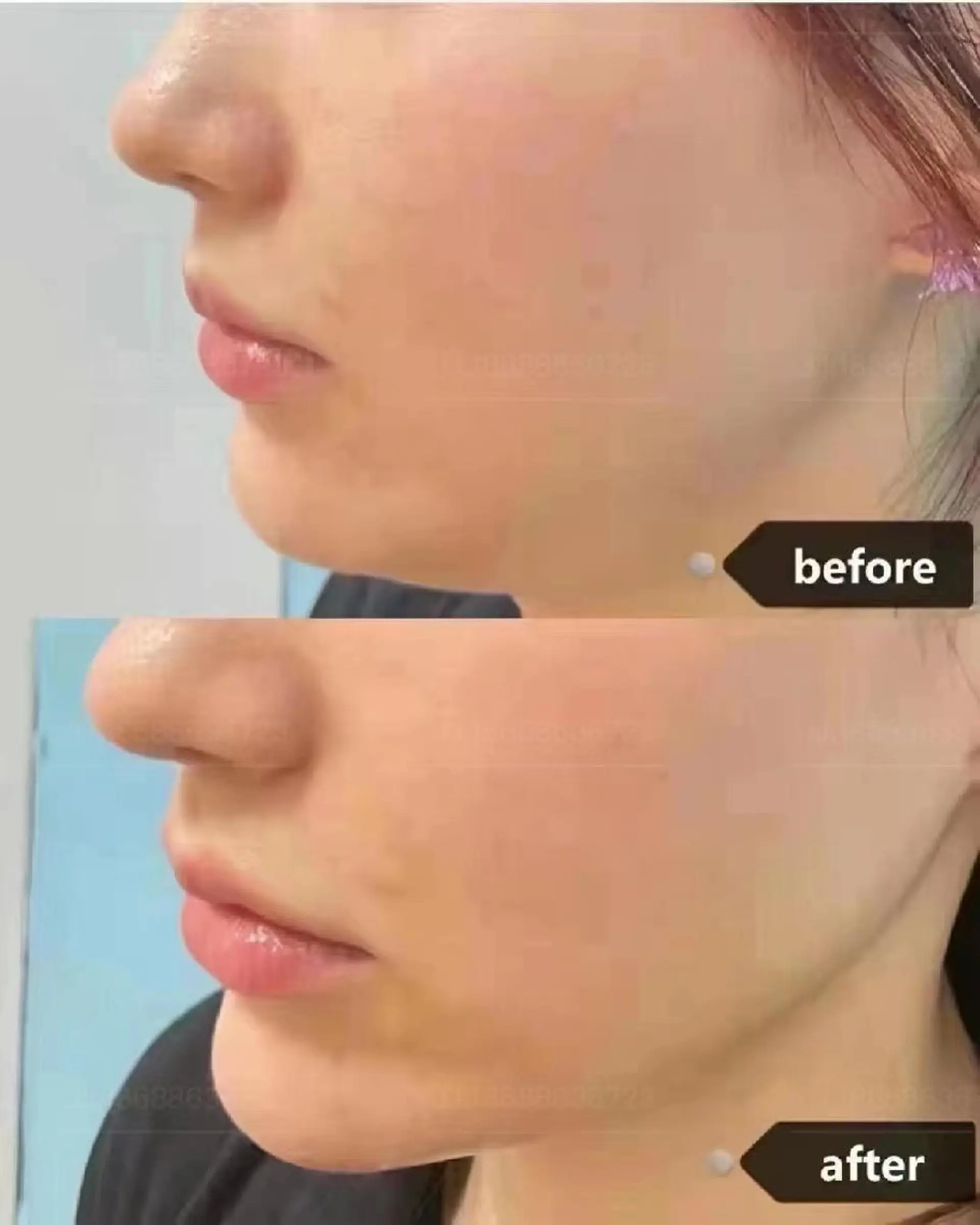 エステ aliaハイフ&水光ジェットサロン所属・aliaハーブ水光店 エステティシャン募集のエステ・リラクイメージ