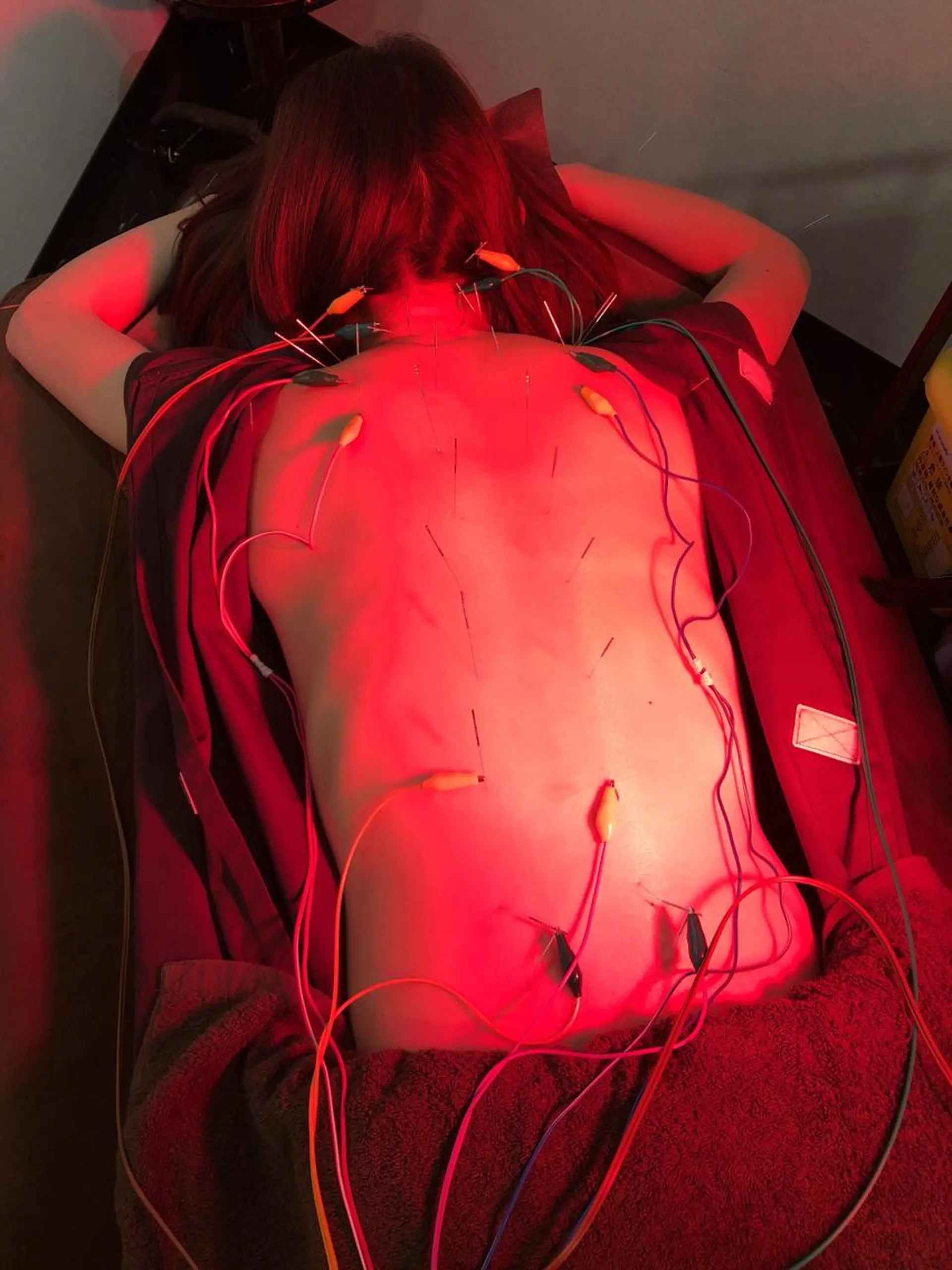 その他 美容鍼灸整体サロンBeauJu所属・小顔矯/美容鍼/鍼灸 BeauJuのその他イメージ