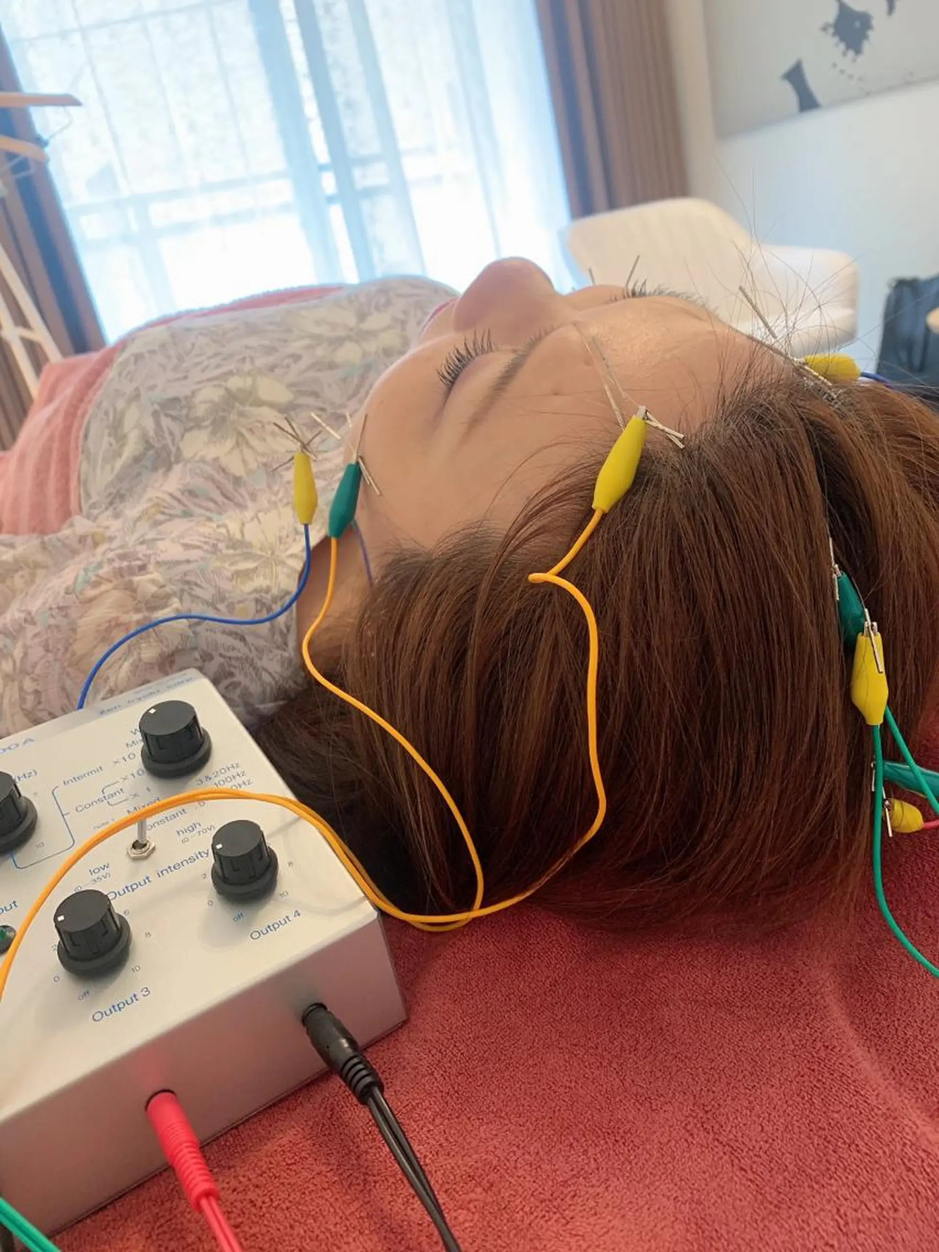 新宿hari-me所属・美容鍼hari-me 新宿のエステ・リラクイメージ