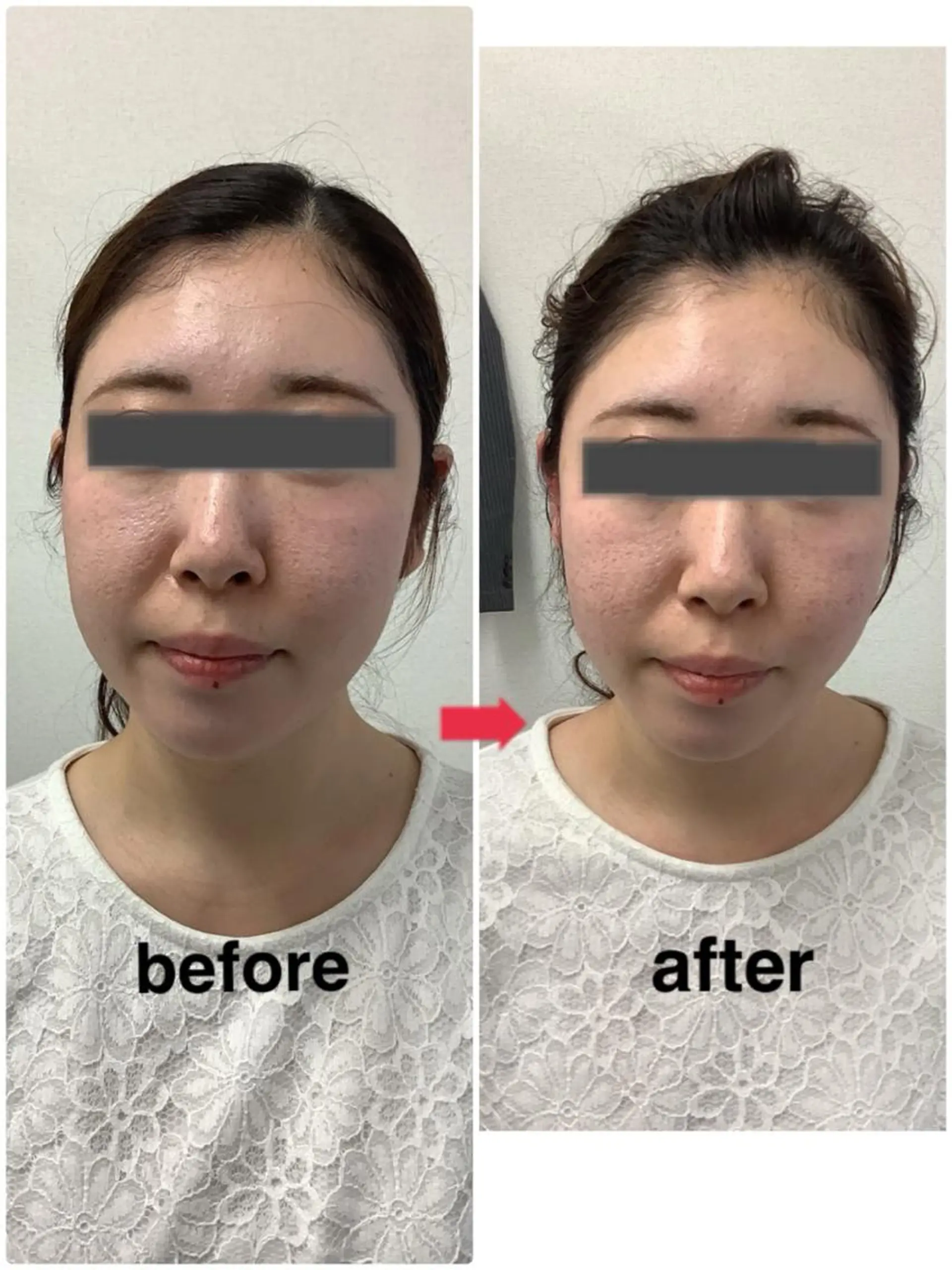 メディカルサロンドオフ所属・ハリサロンドオフ 美容鍼灸×小顔整体のエステ・リラクイメージ