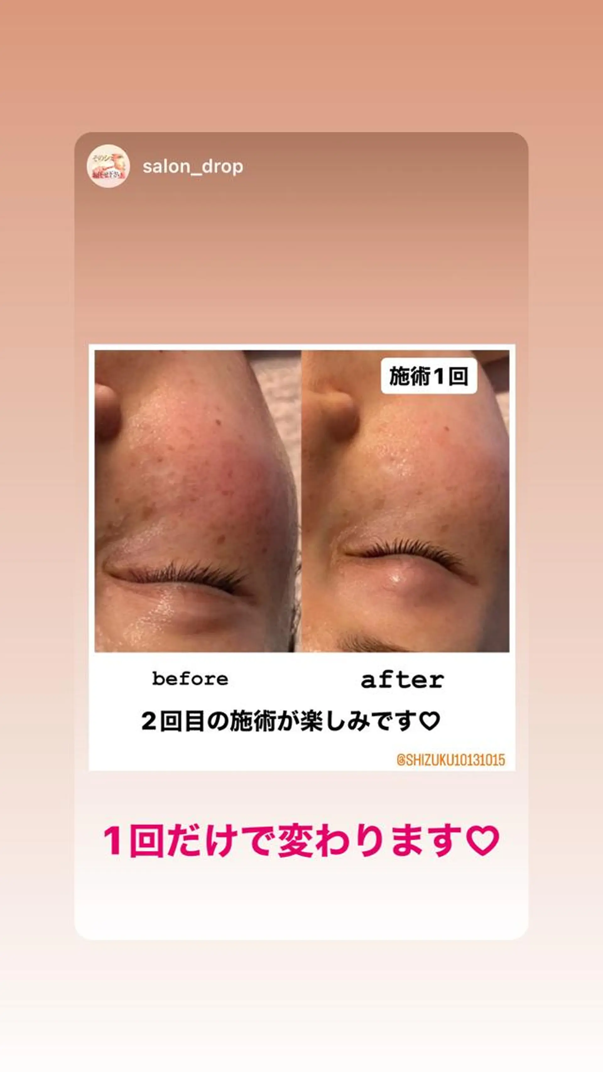 salon＿drop所属・salon dropのエステ・リラクイメージ