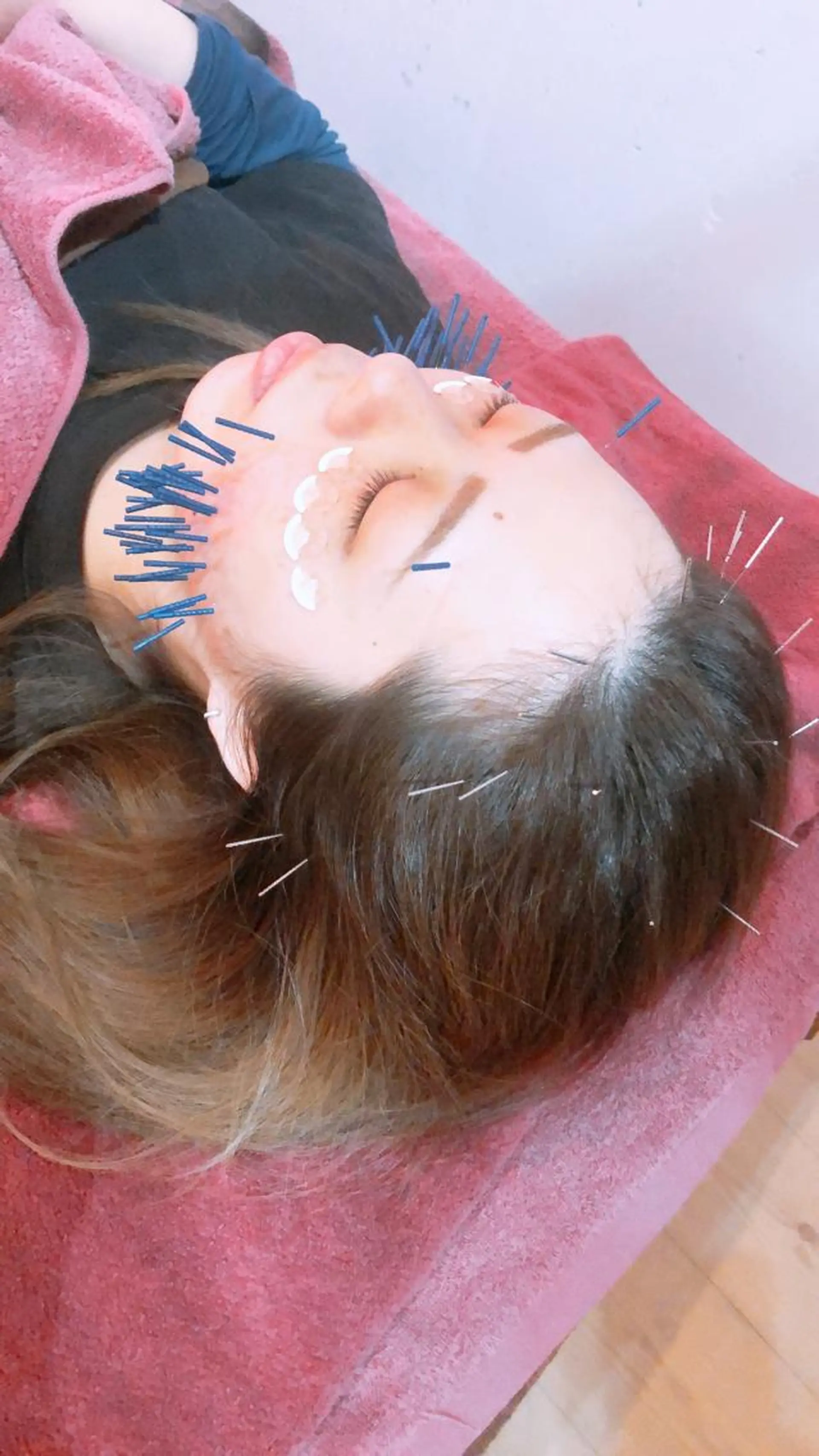 エステ リラク 美容鍼灸女性専用 りんご鍼灸治療院のその他イメージ