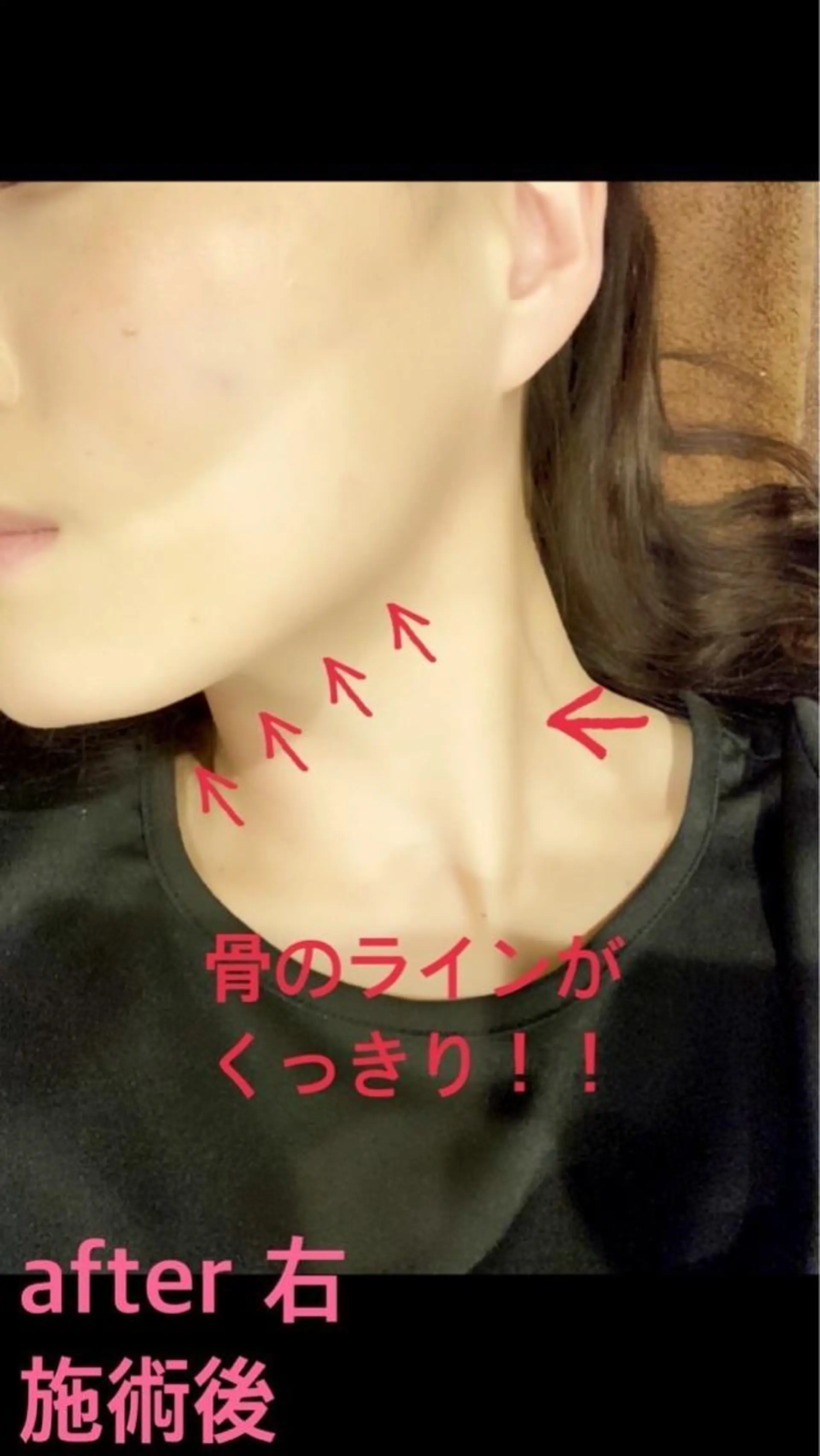 メンズ 美容鍼灸サロン LOMIHARIのエステ・リラクイメージ