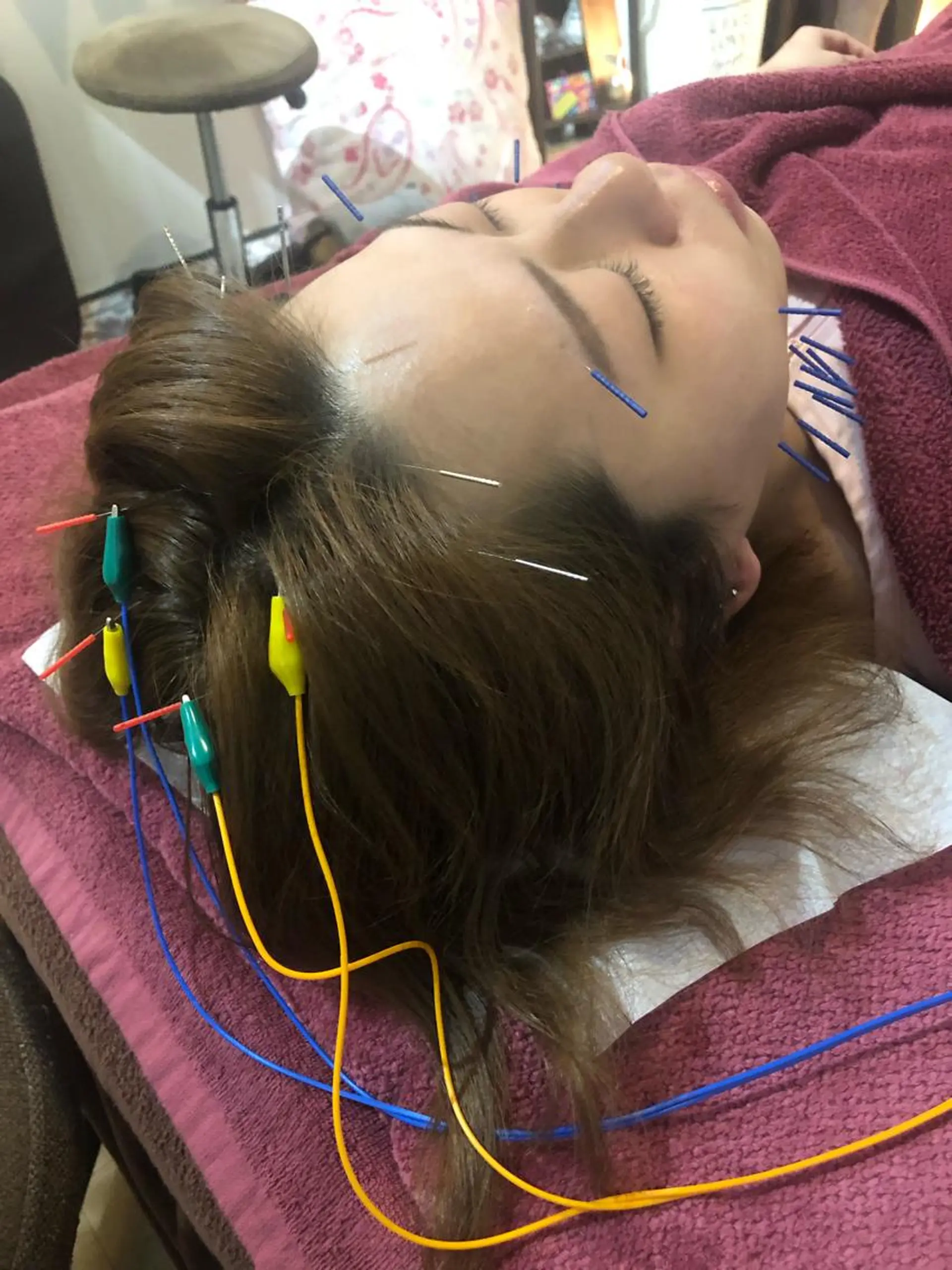 美容鍼灸女性専用 りんご鍼灸治療院のその他イメージ