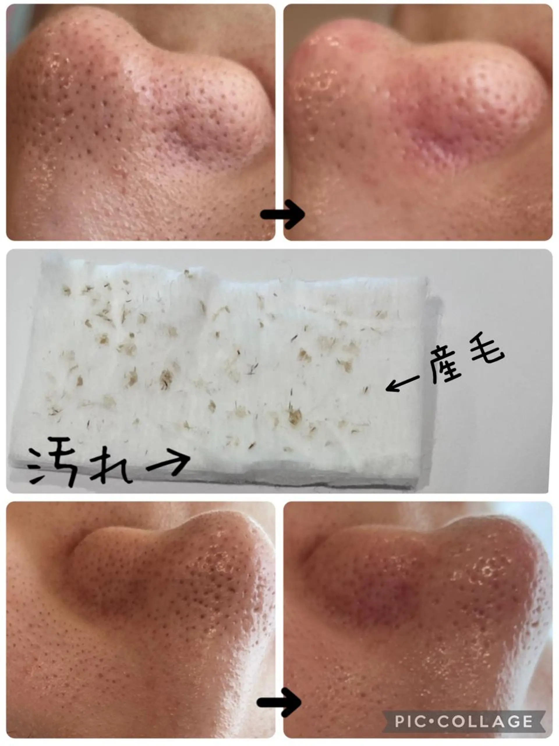 エステ 【リベルハーブピーリング認定店】敏感肌・美白脱毛専門店Dione立川店所属・Dione 立川店のエステ・リラクイメージ