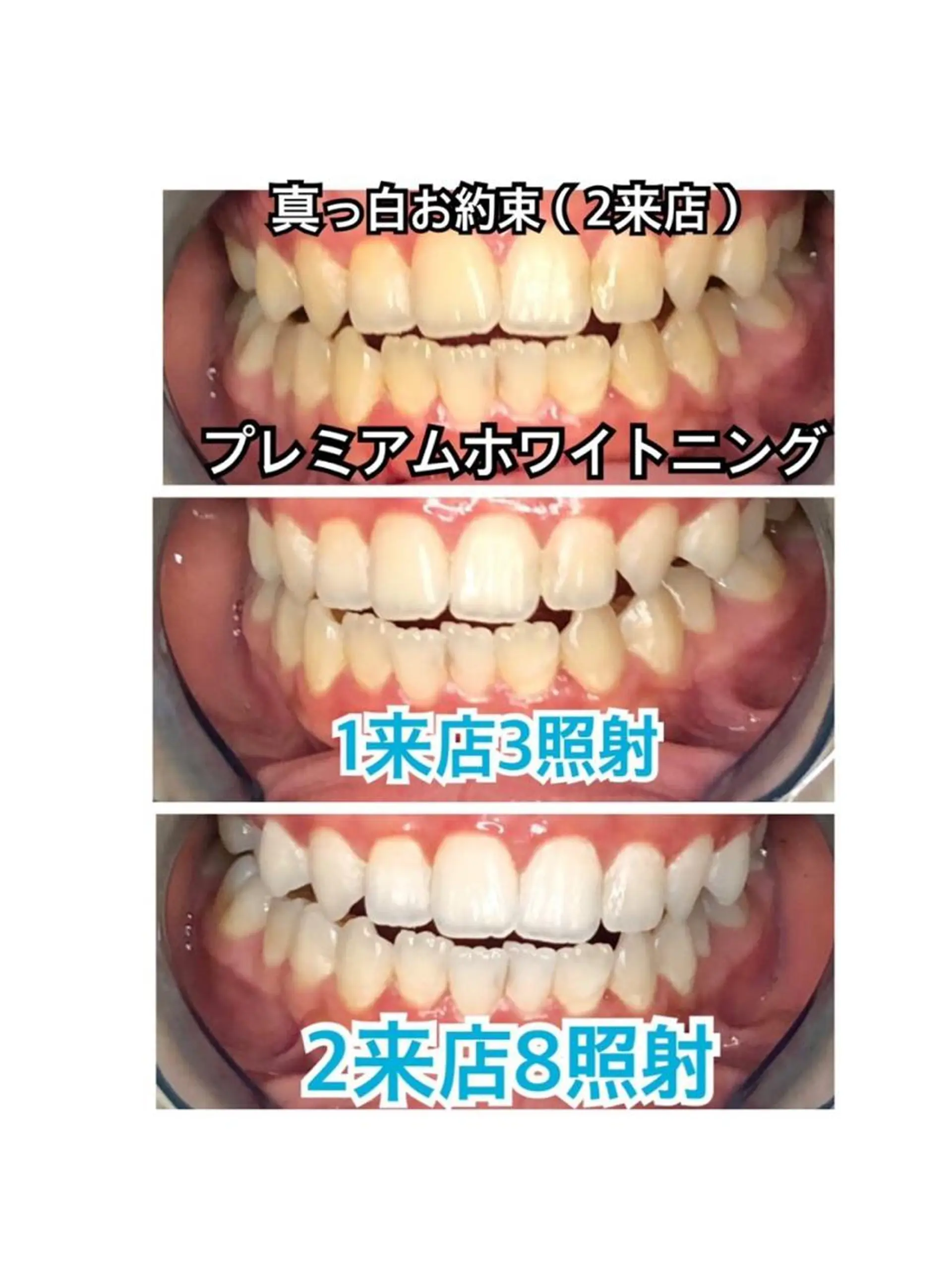 エステ リラク ROYAL ホワイトニング表参道のその他イメージ