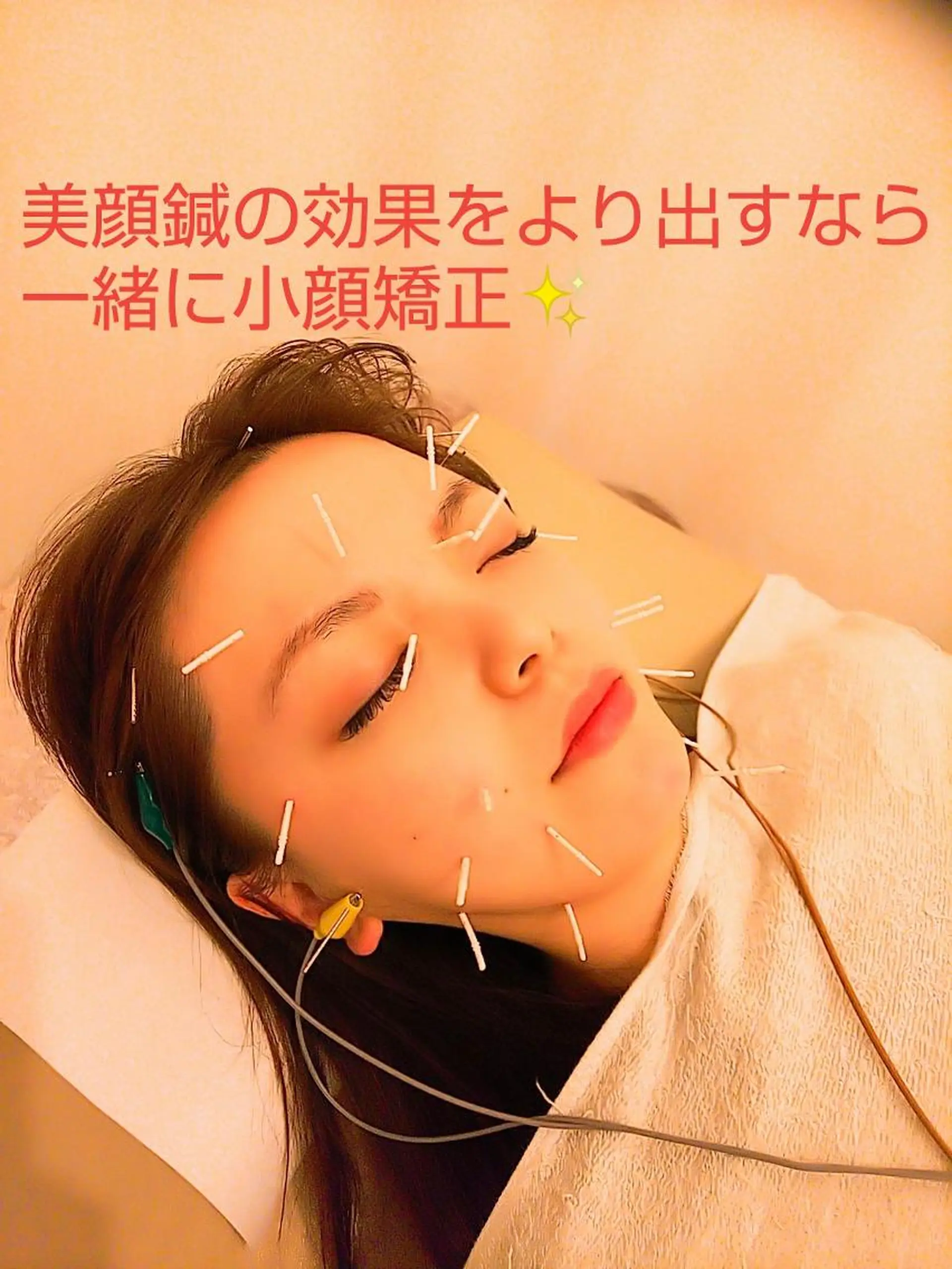 むくみたるみ専門☆ 美容鍼・小顔矯正のエステ・リラクイメージ