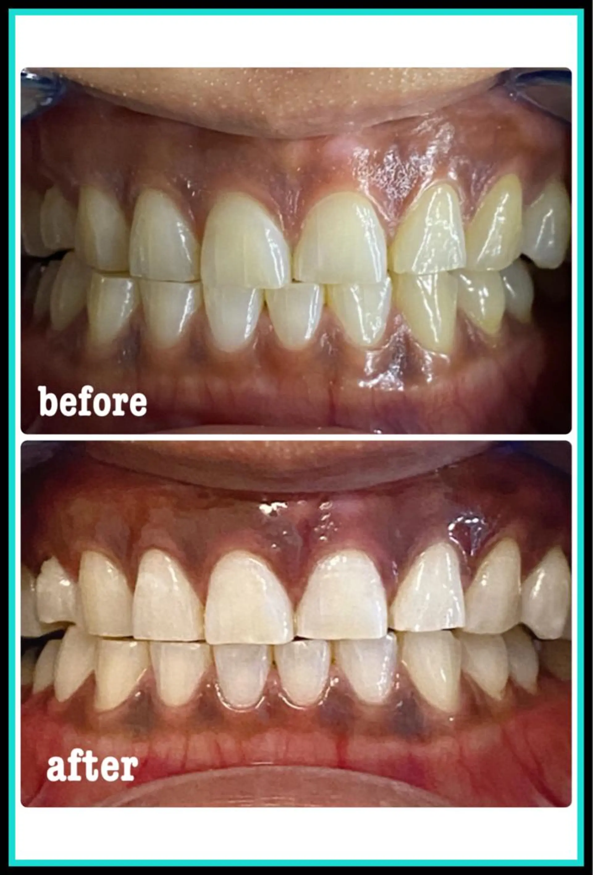 ホワイトニングサロン ラウレアのその他イメージ