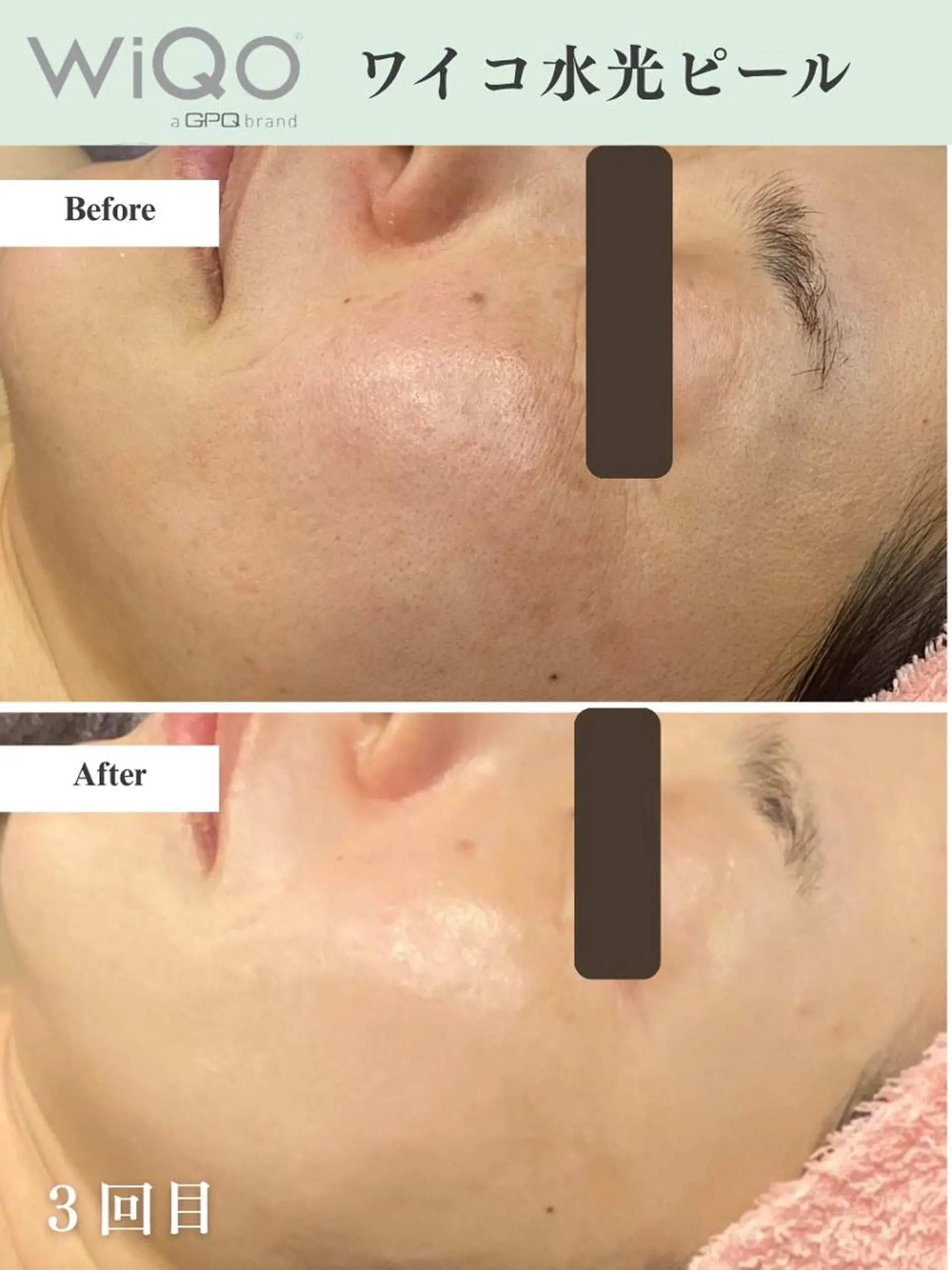 脱毛・眉毛・フェイス サロンN久留米店のその他イメージ