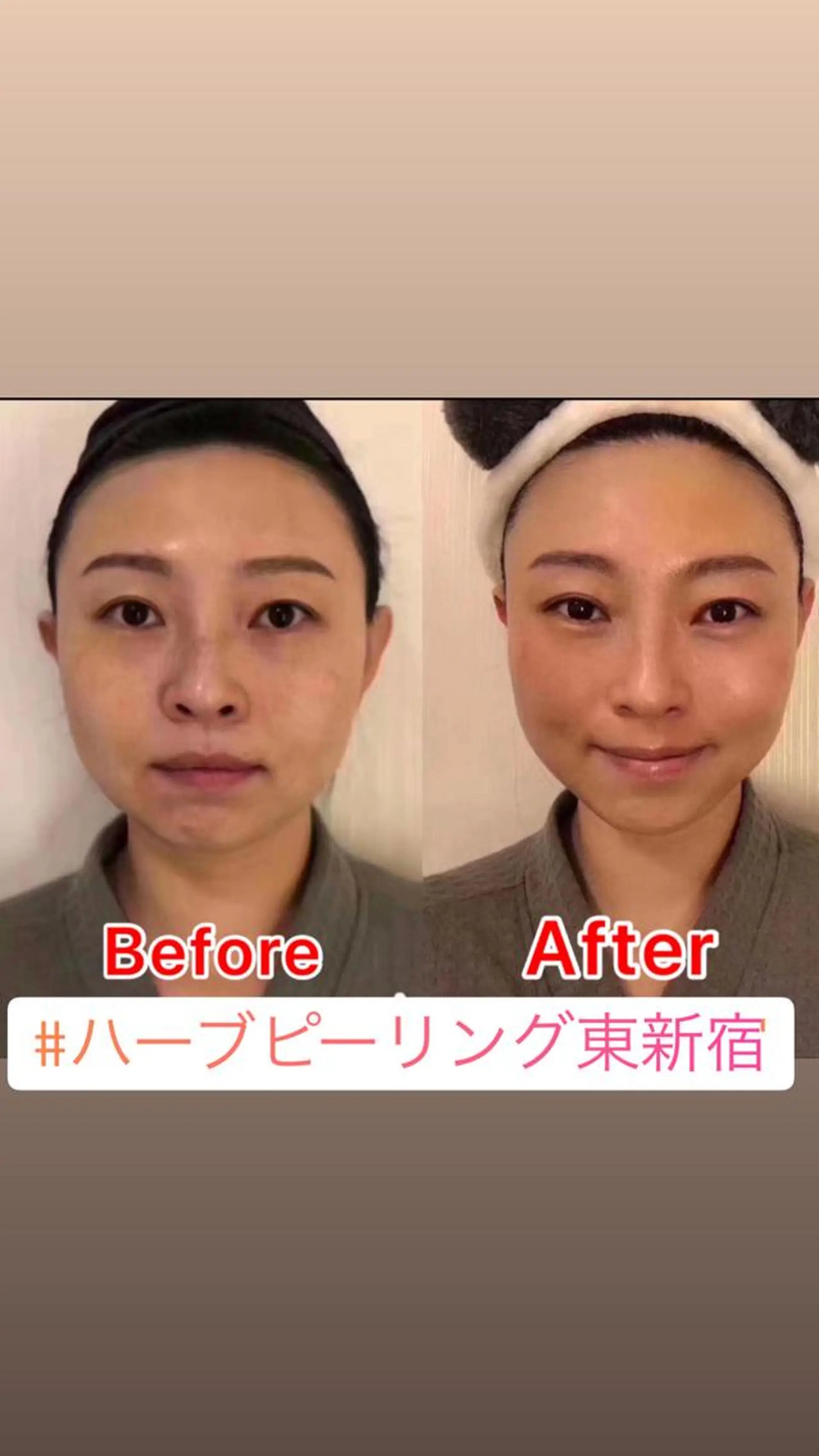 【ハイパーナイフ痩身&小顔コルギ&ハーブピーリング】K-Beauty　東新宿所属・kーbeauty痩身 フェイシャルのエステ・リラクイメージ