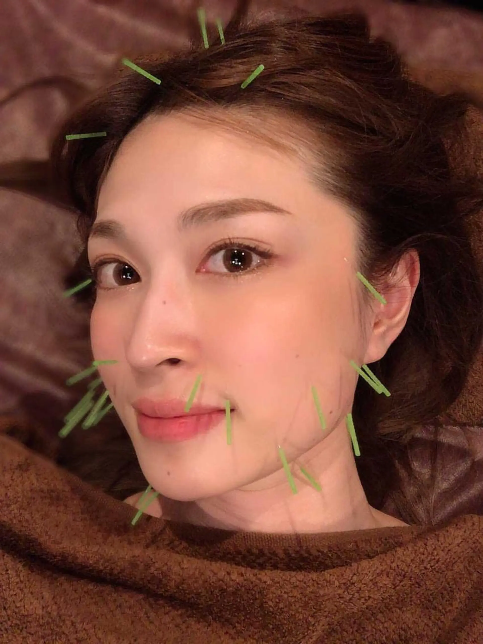 メンズ エステ リラク 美容鍼灸サロン LOMIHARIのエステ・リラクイメージ