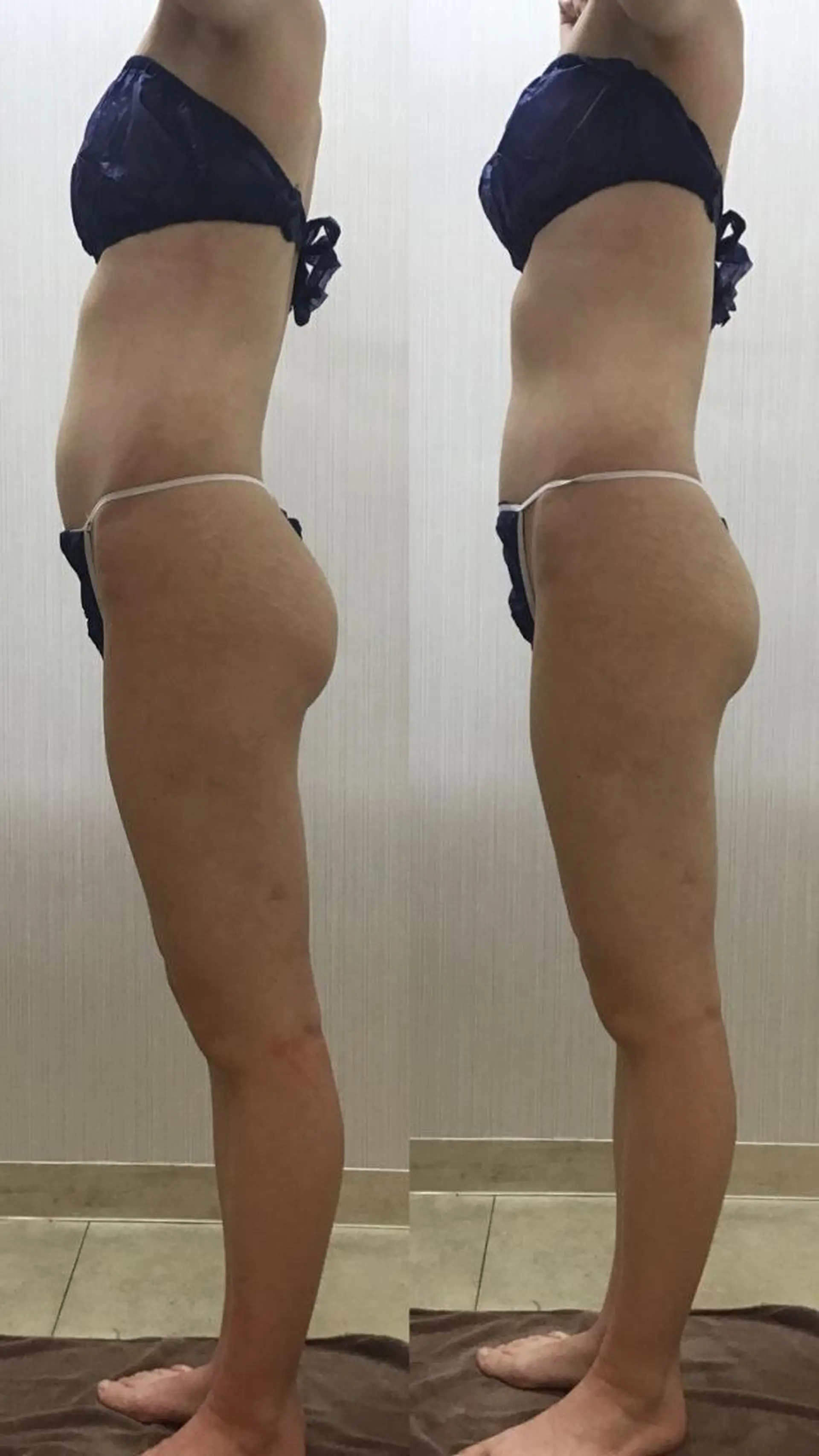 エステ リラク Age24to29 💗RAYVIS池袋のエステ・リラクイメージ