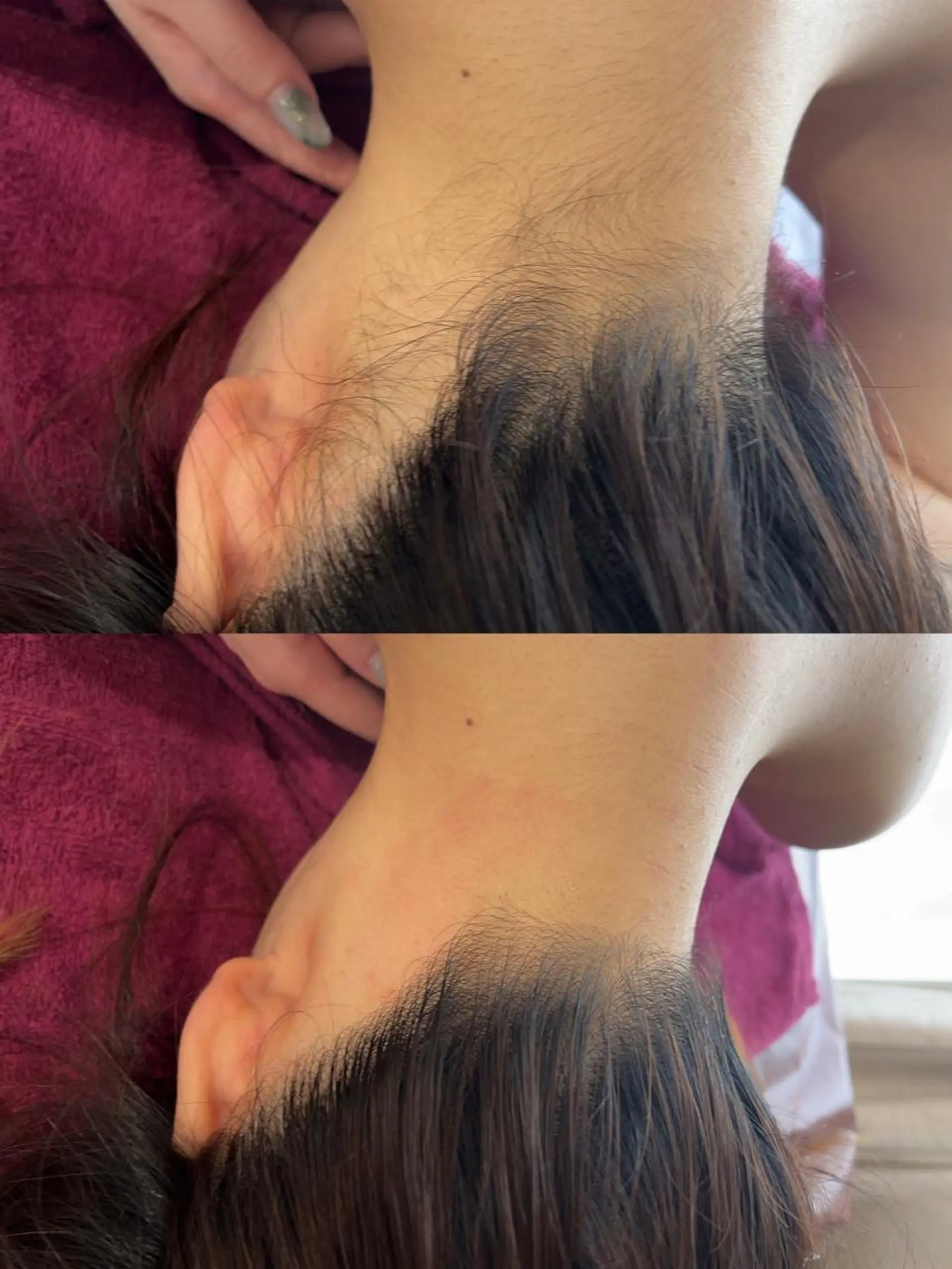 脱毛 Reine BeautySalon所属・毛穴/シミ肝斑/脱毛 横山梨里のエステ・リラクイメージ