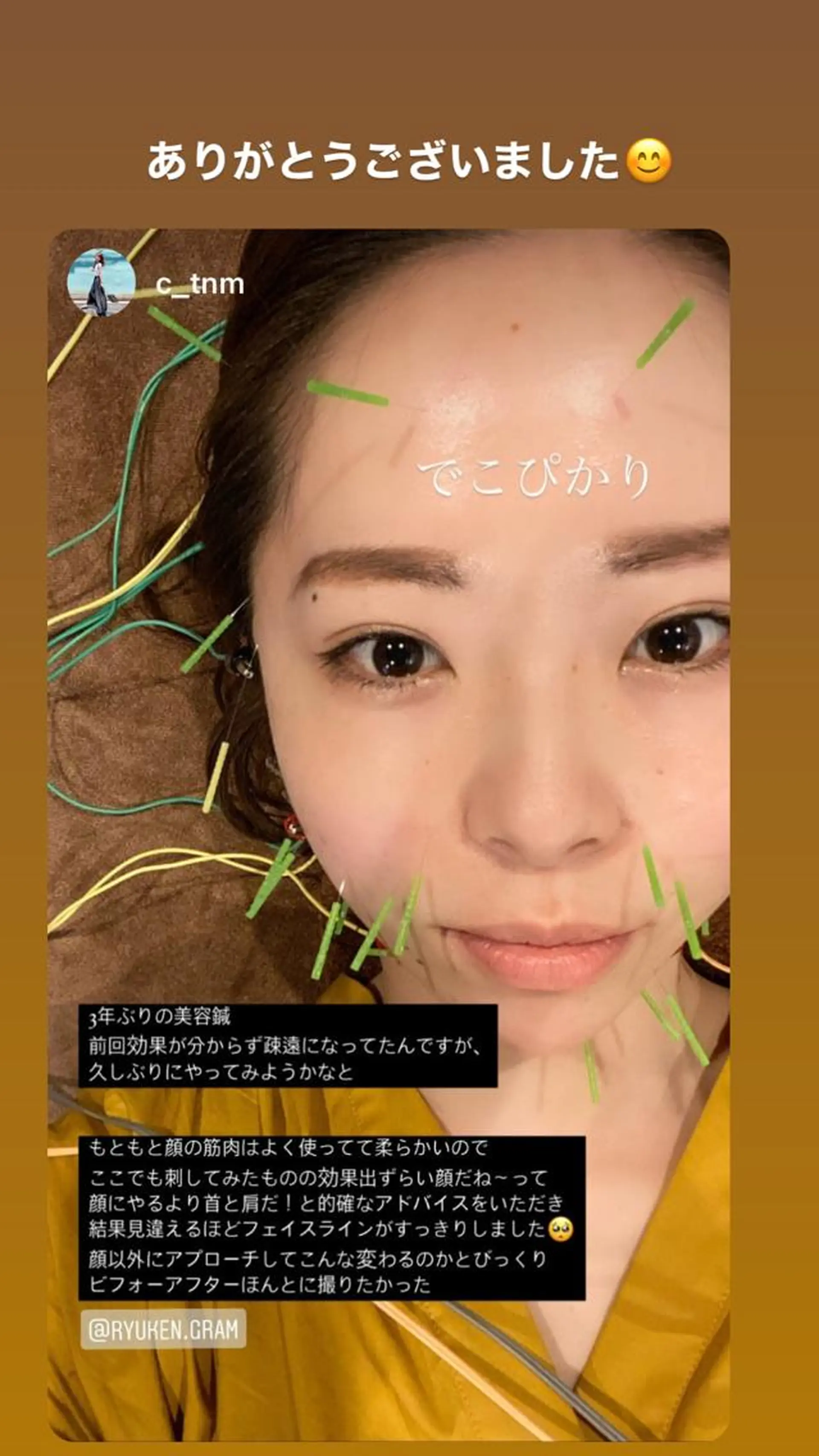 メンズ 美容鍼灸サロン LOMIHARIのエステ・リラクイメージ