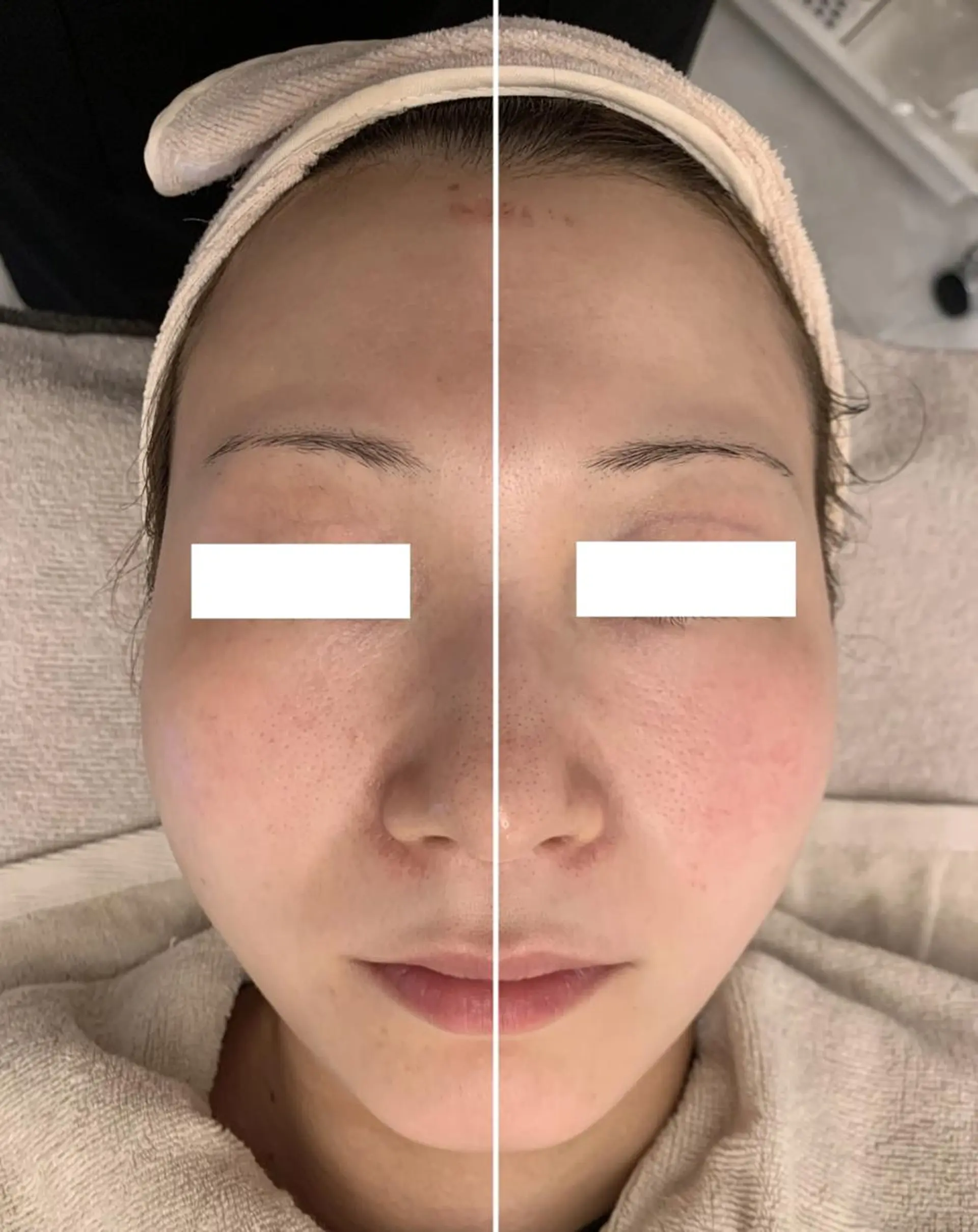 ✨美肌水光✨ アトリエリュバンのエステ・リラクイメージ