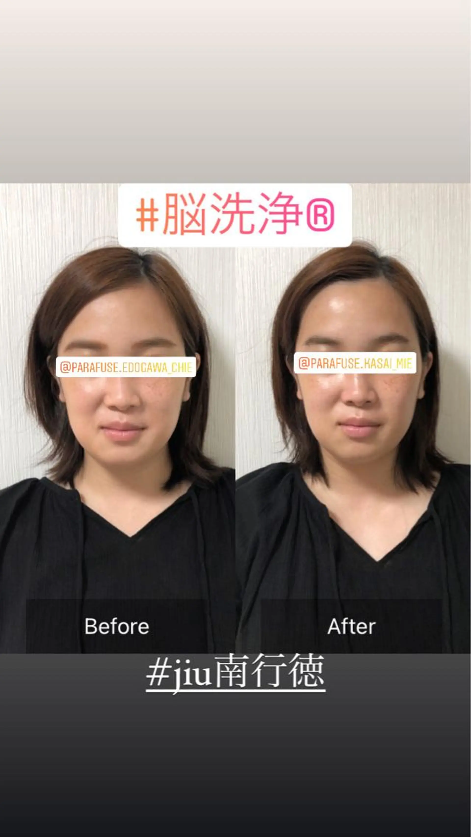 エステ リラク 小顔専門 ヘッドスパ【jiu】のエステ・リラクイメージ