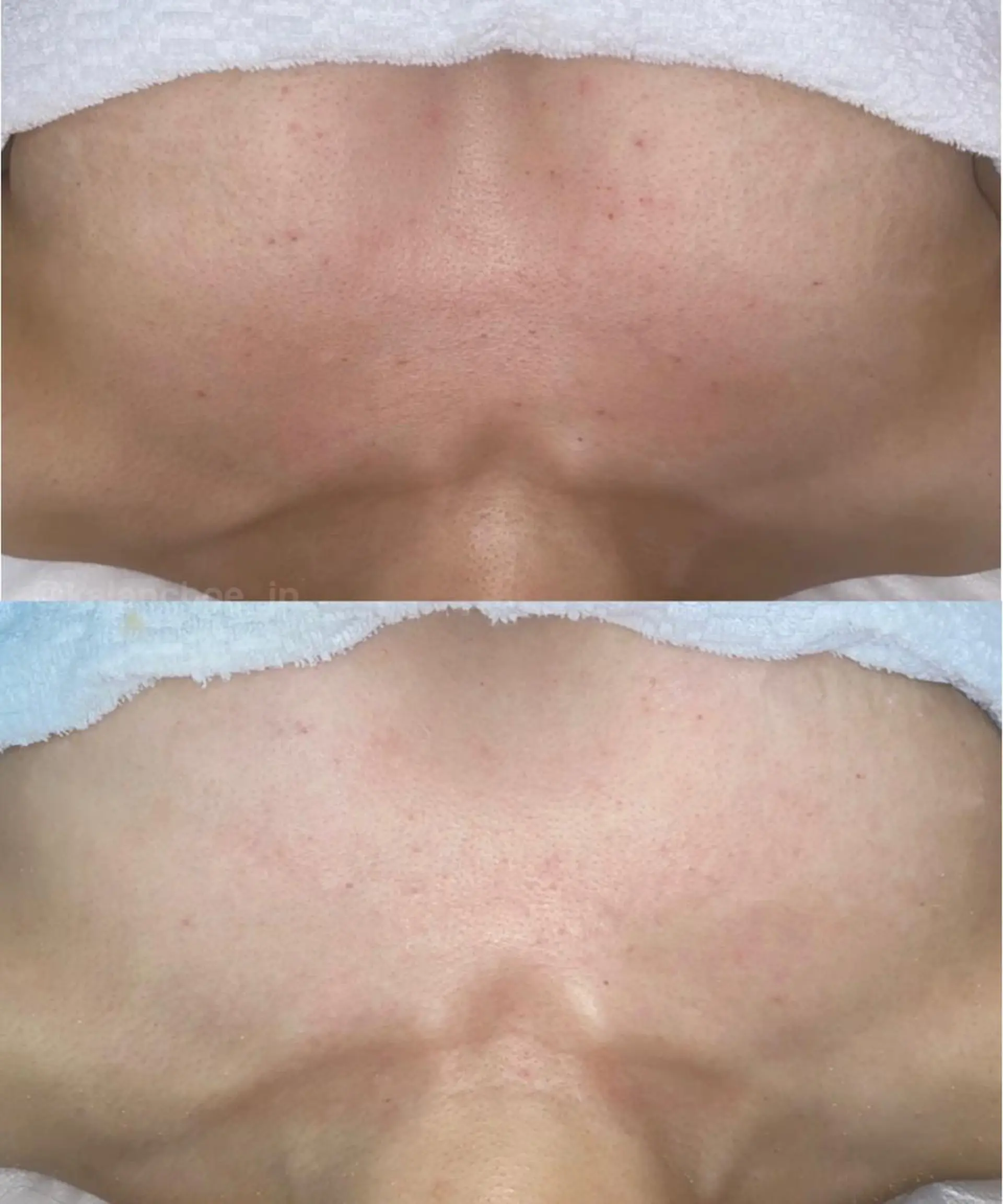 肌質改善 KALANCHOEのエステ・リラクイメージ