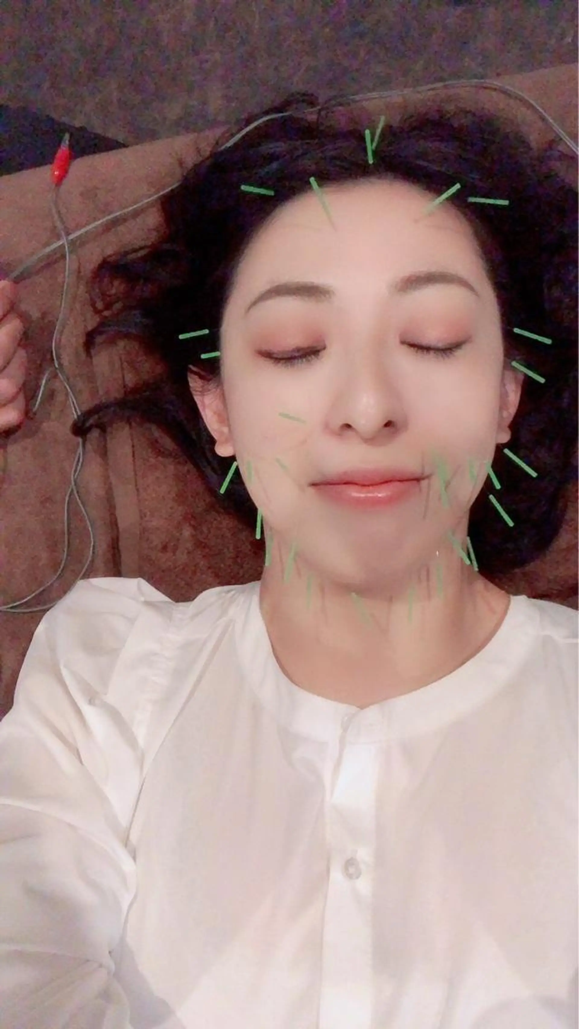 エステ リラク 美容鍼灸サロン LOMIHARIのエステ・リラクイメージ