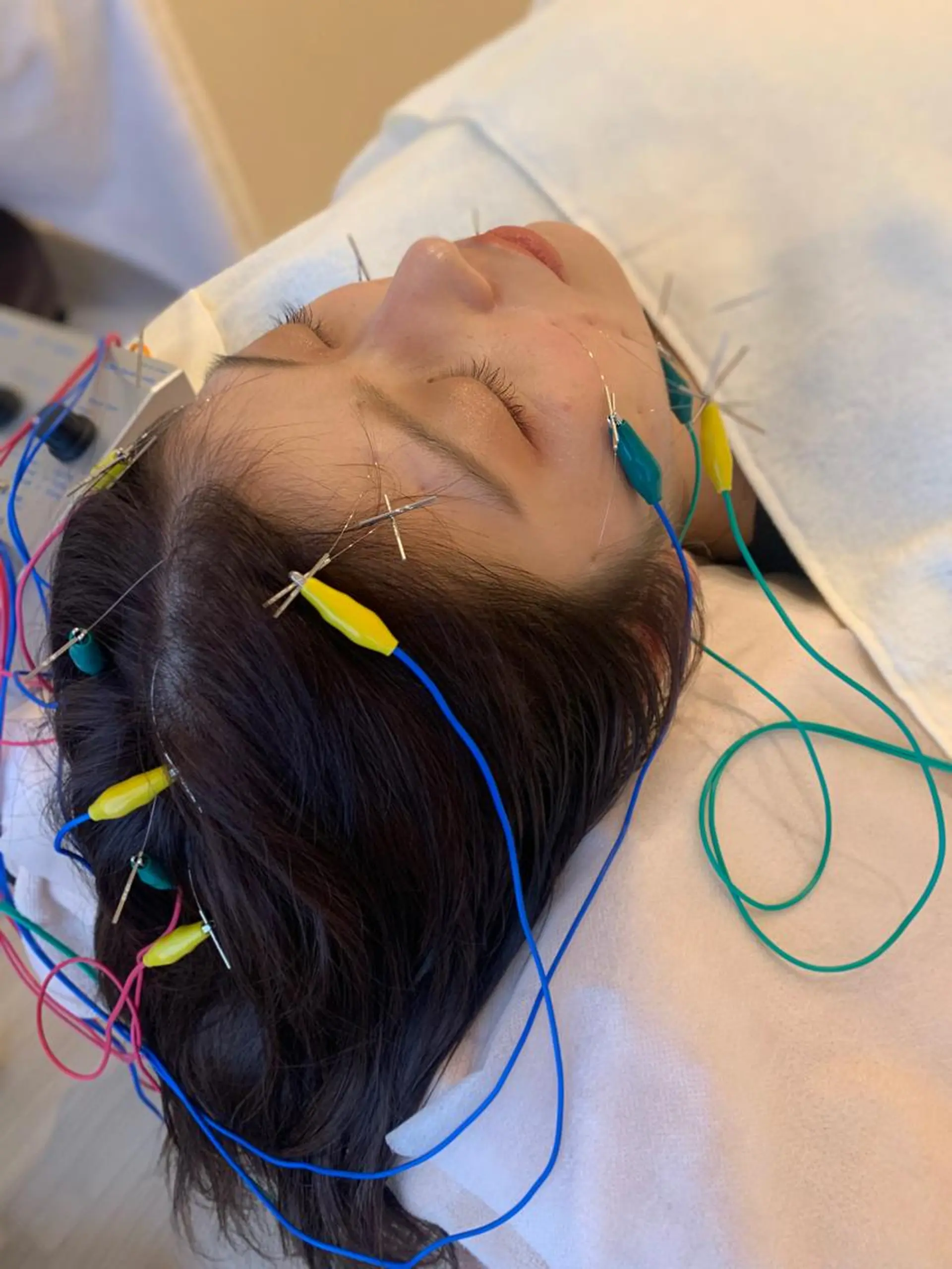 新宿hari-me所属・美容鍼hari-me 新宿のエステ・リラクイメージ